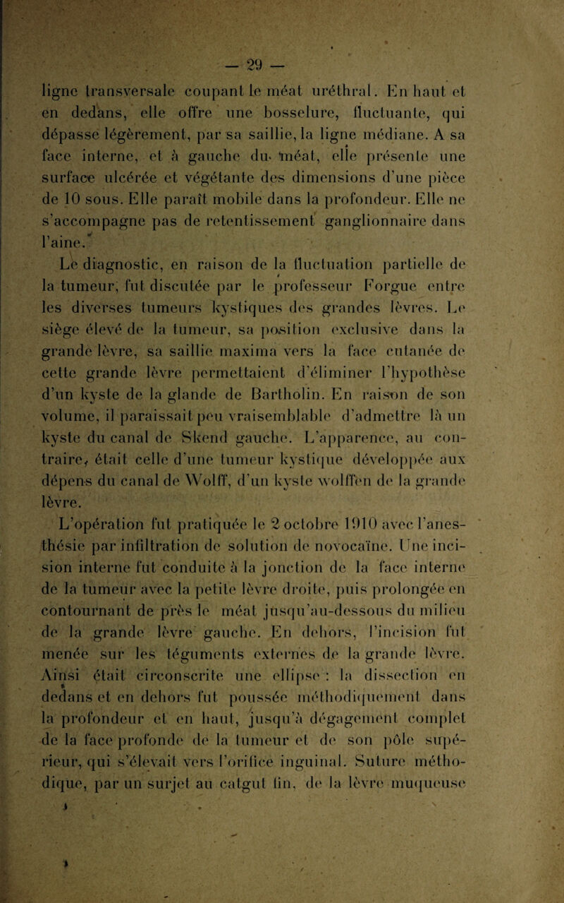 ligne transversale coupant le méat uréthral. En haut et en dedans, elle offre une bosselure, fluctuante, qui dépasse légèrement, par sa saillie, la ligne médiane. A sa face interne, et à gauche dm méat, elle présente une surface ulcérée et végétante dos dimensions d’une pièce de 10 sous. Elle paraît mobile dans la profondeur. Elle ne s’accompagne pas de retentissement ganglionnaire dans 1 aine. Le diagnostic, en raison de la fluctuation partielle de » la tumeur, fut discutée par le professeur Forgue entre les diverses tumeurs kystiques des grandes lèvres. Le siège élevé de la tumeur, sa position exclusive dans la grande lèvre, sa saillie maxima vers la face cutanée de cette grande lèvre permettaient d’éliminer l’hypothèse d’un kyste de la glande de Bartholin. En raison de son volume, il paraissait peu vraisemblable d’admettre là un kyste du canal de Skend gauche. L’apparence, au con¬ traire, était celle d une tumeur kystique développée aux dépens du canal de Wolff, d’un kyste wolflen de la grande lèvre. L’opération fut pratiquée le 2 octobre 1910 avec l’anes¬ thésie par infiltration de solution de novocaïne. Une inci¬ sion interne fut conduite à la jonction de la face interne de la tumeur avec la petite lèvre droite, puis prolongée en contournant de près le méat jusqu’au-dessous du milieu de la grande lèvre gauche. En dehors, l’incision fut menée sur les téguments externes de la grande lèvre. Ainsi était circonscrite une ellipse : la dissection en dedans et en dehors fut poussée méthodiquement dans la profondeur et en haut, jusqu’à dégagement complet de la face profonde de la tumeur et de son pôle sirpé- dique, par un surjet au catgut lin, de la lèvre-muqueuse > N %