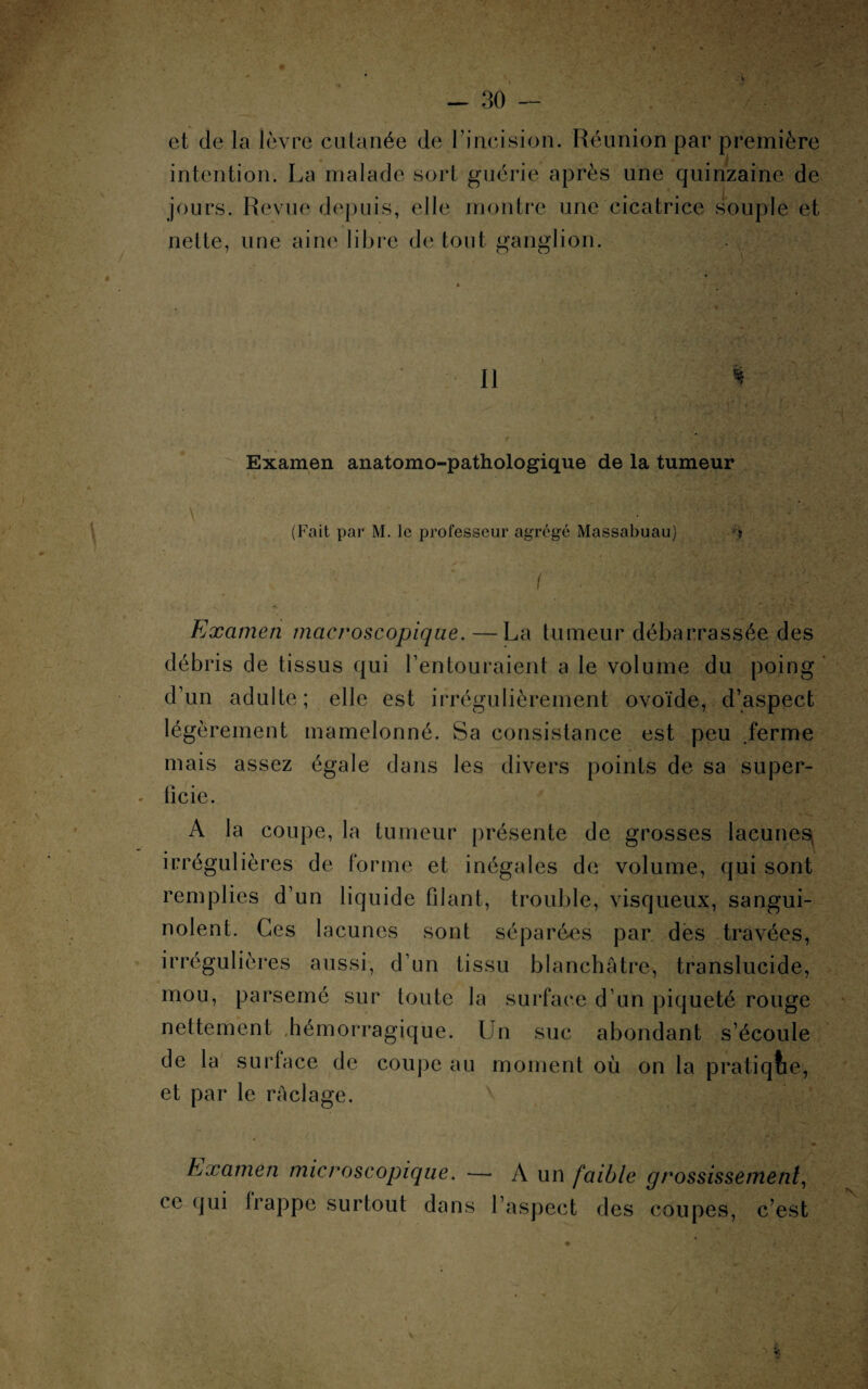 et de la lèvre cutanée de l’incision. Réunion par première intention. La malade sort guérie après une quinzaine de jours. Revue depuis, elle montre une cicatrice souple et nette, une aine libre de tout ganglion. Il % Examen anatomo-pathologique de la tumeur (Fait par M. le professeur agrégé Massabuau) Examen macroscopique. — La tumeur débarrassée des débris de tissus qui l’entouraient a le volume du poing d’un adulte; elle est irrégulièrement ovoïde, d’aspect légèrement mamelonné. Sa consistance est peu .ferme mais assez égale dans les divers points de sa super¬ ficie. A la coupe, la tumeur présente de grosses lacunes, irrégulières de forme et inégales de volume, qui sont remplies d’un liquide filant, trouble, visqueux, sangui¬ nolent. Ces lacunes sont séparées par des travées, irrégulières aussi, d’un tissu blanchâtre, translucide, mou, parsemé sur toute la surface d’un piqueté rouge nettement .hémorragique. Un suc abondant s’écoule de la surface de coupe au moment où on la pratique, et par le raclage. Examen microscopique. — A un faible grossissement, ce (jui Irappe surtout dans l’aspect des coupes, c’est »