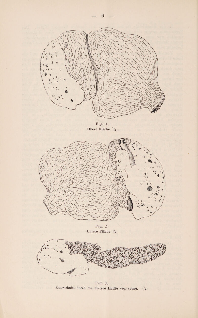 Fig. 1. Obere Fläche 1/4. Fig. 2. Untere Fläche x/4- Fig. 3. Querschnitt durch die hintere Hälfte von vorne. y4.