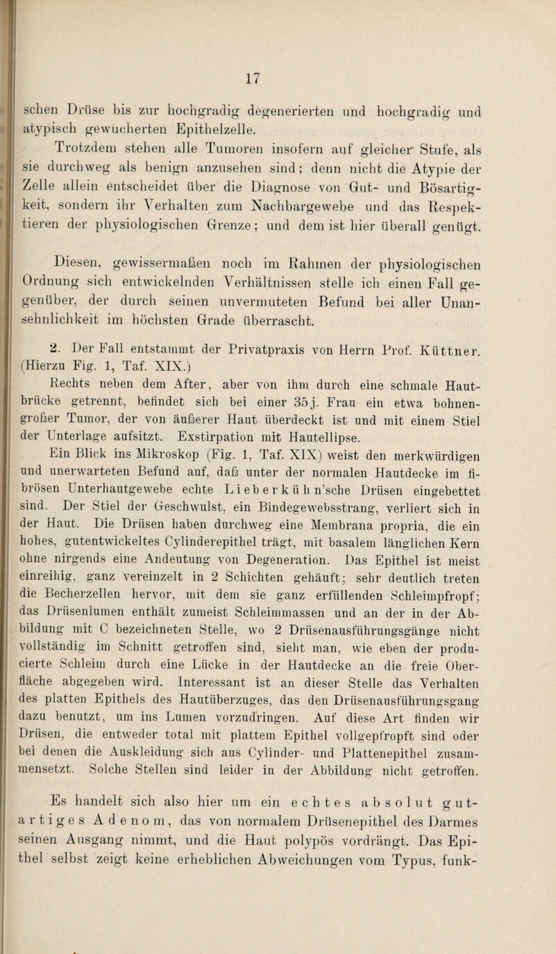 sehen Drüse bis zur hochgradig degenerierten und hochgradig und atypisch gewucherten Epithelzelle. Trotzdem stehen alle Tumoren insofern auf gleicher Stufe, als sie durchweg als benign anzusehen sind; denn nicht die Atypie der Zelle allein entscheidet über die Diagnose von Gut- und Bösartig- keit, sondern ihr Verhalten zum Nachbargewebe und das Respek¬ tieren der physiologischen Grenze; und dem ist hier überall genügt. Diesen, gewissermaßen noch im Rahmen der physiologischen Ordnung sich entwickelnden Verhältnissen stelle ich einen Fall ge¬ genüber, der durch seinen unvermuteten Befund bei aller Unan¬ sehnlichkeit im höchsten Grade überrascht. 2. Der Fall entstammt der Privatpraxis von Herrn Prof. Küttner. (Hierzu Fig. 1, Taf. XIX.) Rechts neben dem After, aber von ihm durch eine schmale Haut¬ brücke getrennt, belindet sich bei einer 35 j. Frau ein etwa bohnen¬ großer Tumor, der von äußerer Haut überdeckt ist und mit einem Stiel der Unterlage aufsitzt. Exstirpation mit Hautellipse. Ein Blick ins Mikroskop (Fig. 1, Taf. XIX) weist den merkwürdigen und unerwarteten Befund auf, daß unter der normalen Hautdecke im fi¬ brösen Unterhautgewebe echte L i e b e r k ü h n’sche Drüsen eingebettet sind. Der Stiel der Geschwulst, ein Bindegewebsstrang, verliert sich in der Haut. Die Drüsen haben durchweg eine Membrana propria, die ein hohes, gutentwickeltes Cylinderepithel trägt, mit basalem länglichen Kern ohne nirgends eine Andeutung von Degeneration. Das Epithel ist meist einreihig, ganz vereinzelt in 2 Schichten gehäuft; sehr deutlich treten die Becherzellen hervor, mit dem sie ganz erfüllenden Schleimpfropf; das Drüsenlumen enthält zumeist Schleimmassen und an der in der Ab¬ bildung mit C bezeichneten Stelle, wo 2 Drüsenausführungsgänge nicht vollständig im Schnitt getroffen sind, sieht man, wie eben der produ- cierte Schleim durch eine Lücke in der Hautdecke an die freie Ober¬ fläche abgegeben wird. Interessant ist an dieser Stelle das Verhalten des platten Epithels des Hautüberzuges, das den Drüsenausführungsgang dazu benutzt, um ins Lumen vorzudringen. Auf diese Art finden wir Drüsen, die entweder total mit plattem Epithel vollgepfropft sind oder bei denen die Auskleidung sich aus Cylinder- und Plattenepithel zusam¬ mensetzt. Solche Stellen sind leider in der Abbildung nicht getroffen. Es handelt sich also hier um ein echtes absolut gut¬ artiges Aden o m, das von normalem Drüsenepithel des Darmes seinen Ausgang nimmt, und die Haut polypös vordrängt. Das Epi¬ thel selbst zeigt keine erheblichen Abweichungen vom Typus, funk-