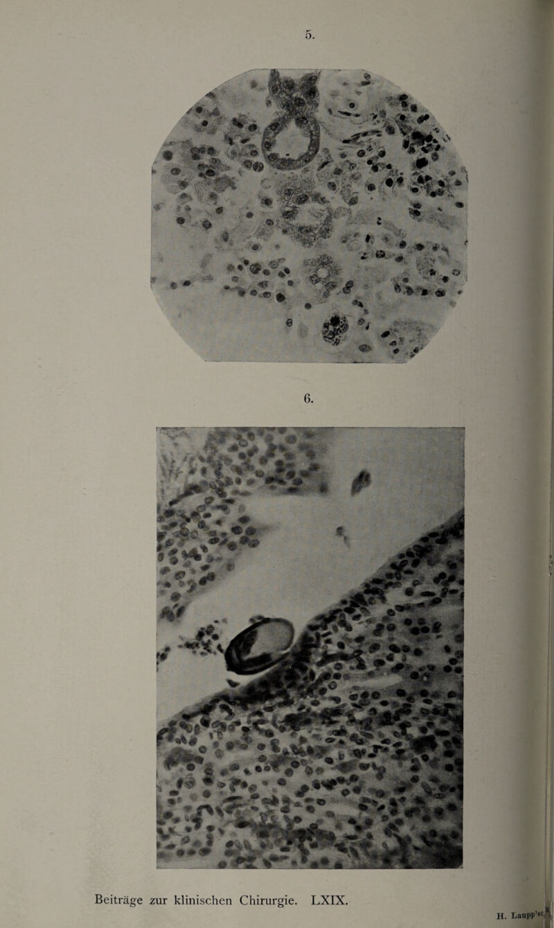 Beiträge zur klinischen Chirurgie. LXIX. H. Laupp’