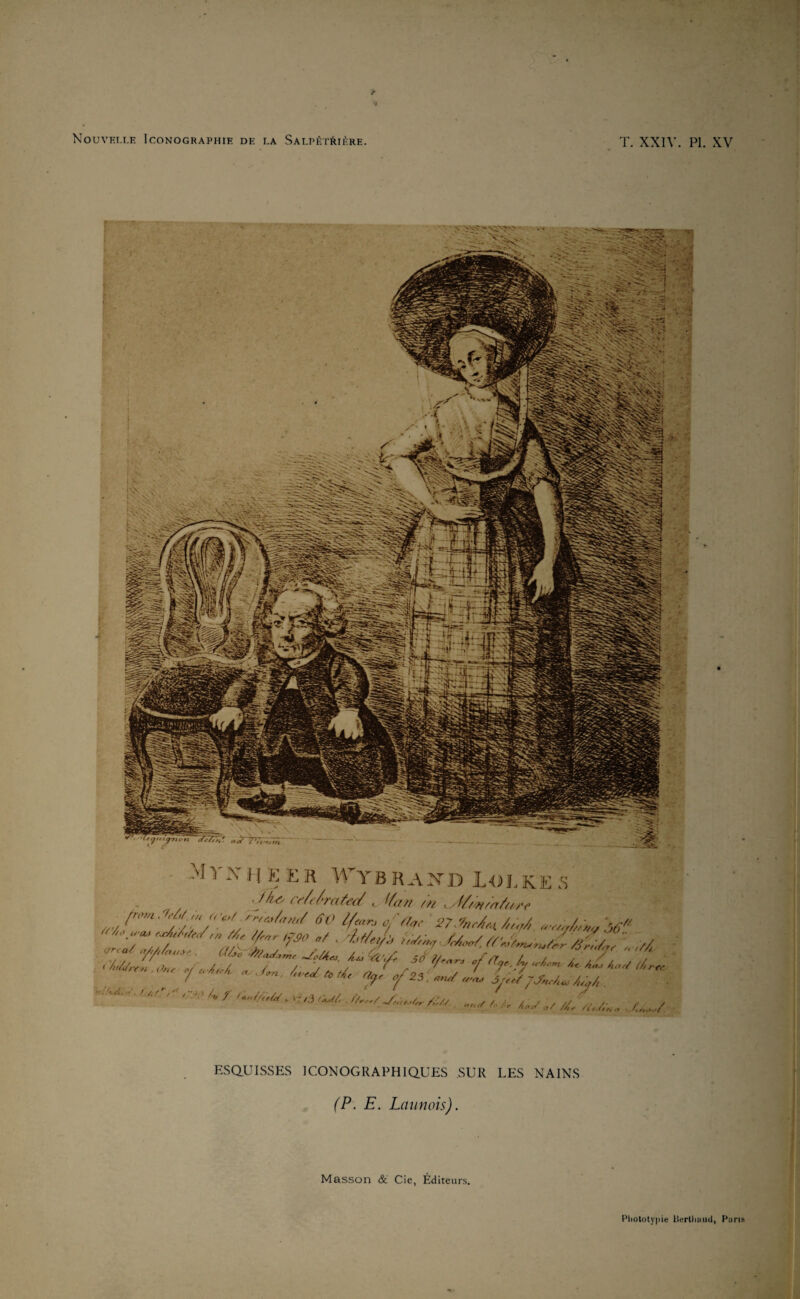 Nouveli.h Iconographie de i.a Sai.pkirière. T. XXIV. PI. XV -M VX IJ K E R Wyb RAXD L<JLKi: .S c if a fl />/ //(/'(> ESQUISSES ICONOGRAPHIQUES SUR LES NAINS I I (P. E. Launois). | J Masson & Cie, Éditeurs. Pliototypie lierlliiiud, Pans