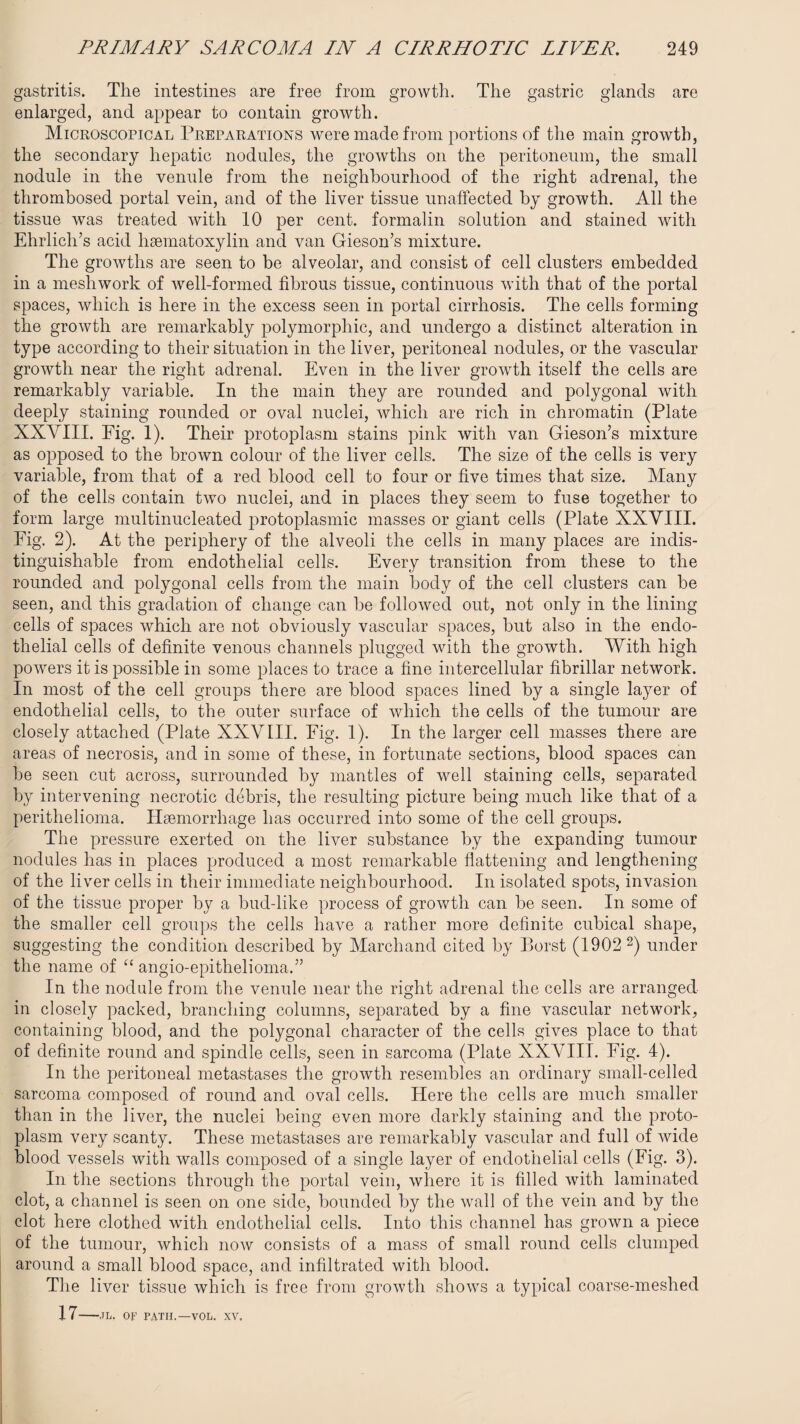 gastritis. The intestines are free from growth. The gastric glands are enlarged, and appear to contain growth. Microscopical Preparations were made from portions of the main growth, the secondary hepatic nodules, the growths on the peritoneum, the small nodule in the venule from the neighbourhood of the right adrenal, the thrombosed portal vein, and of the liver tissue unaffected by growth. All the tissue was treated with 10 per cent, formalin solution and stained with Ehrlich’s acid haematoxylin and van Gieson’s mixture. The growths are seen to be alveolar, and consist of cell clusters embedded in a mesh work of well-formed fibrous tissue, continuous with that of the portal spaces, which is here in the excess seen in portal cirrhosis. The cells forming the growth are remarkably polymorphic, and undergo a distinct alteration in type according to their situation in the liver, peritoneal nodules, or the vascular growth near the right adrenal. Even in the liver growth itself the cells are remarkably variable. In the main they are rounded and polygonal with deeply staining rounded or oval nuclei, which are rich in chromatin (Plate XXVIII. Eig. 1). Their protoplasm stains pink with van Gieson’s mixture as opposed to the brown colour of the liver cells. The size of the cells is very variable, from that of a red blood cell to four or five times that size. Many of the cells contain two nuclei, and in places they seem to fuse together to form large multinucleated protoplasmic masses or giant cells (Plate XXVIII. Fig. 2). At the periphery of the alveoli the cells in many places are indis¬ tinguishable from endothelial cells. Every transition from these to the rounded and polygonal cells from the main body of the cell clusters can be seen, and this gradation of change can be followed out, not only in the lining cells of spaces which are not obviously vascular spaces, but also in the endo¬ thelial cells of definite venous channels plugged with the growth. With high powers it is possible in some places to trace a fine intercellular fibrillar network. In most of the cell groups there are blood spaces lined by a single layer of endothelial cells, to the outer surface of which the cells of the tumour are closely attached (Plate XXVIII. Eig. 1). In the larger cell masses there are areas of necrosis, and in some of these, in fortunate sections, blood spaces can be seen cut across, surrounded by mantles of well staining cells, separated by intervening necrotic debris, the resulting picture being much like that of a perithelioma. Haemorrhage has occurred into some of the cell groups. The pressure exerted on the liver substance by the expanding tumour nodules has in places produced a most remarkable flattening and lengthening of the liver cells in their immediate neighbourhood. In isolated spots, invasion of the tissue proper by a bud-like process of growth can be seen. In some of the smaller cell groups the cells have a rather more definite cubical shape, suggesting the condition described by Marchand cited by Borst (1902 2) under the name of “ angio-epithelioma.” In the nodule from the venule near the right adrenal the cells are arranged in closely packed, branching columns, separated by a fine vascular network, containing blood, and the polygonal character of the cells gives place to that of definite round and spindle cells, seen in sarcoma (Plate XXVIII. Eig. 4). In the peritoneal metastases the growth resembles an ordinary small-celled sarcoma composed of round and oval cells. Here the cells are much smaller than in the liver, the nuclei being even more darkly staining and the proto¬ plasm very scanty. These metastases are remarkably vascular and full of wide blood vessels with walls composed of a single layer of endothelial cells (Fig. 3). In the sections through the portal vein, where it is filled with laminated clot, a channel is seen on one side, bounded by the wall of the vein and by the clot here clothed with endothelial cells. Into this channel has grown a piece of the tumour, which now consists of a mass of small round cells clumped around a small blood space, and infiltrated with blood. The liver tissue which is free from growth shows a typical coarse-meshed 17-,TL. OF PATH.—VOL. XV.