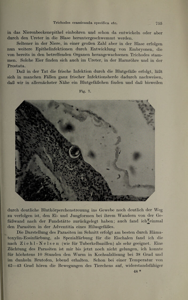 in das Nierenbeckenepithel einbohren und schon da entwickeln oder aber durch den Ureter in die Blase heruntergeschwemmt werden. Seltener in der Niere, in einer großen Zahl aber in der Blase erfolgen nun weitere Epithelinfektionen durch Entwicklung von Embryonen, die von bereits in den betreffenden Organen herangewachsenen Trichodes stam¬ men. Solche Eier finden sich auch im Ureter, in der Harnröhre und in der Prostata. Daß in der Tat die frische Infektion durch die Blutgefäße erfolgt, läßt sich in manchen Fällen ganz frischer Infektionsherde dadurch nach weisen, daß wir in allernächster Nähe ein Blutgefäßchen finden und daß bisweilen Fig. 7. durch deutliche Blutkörperchenstreuung ins Gewebe noch deutlich der Weg zu verfolgen ist, den Ei- und Jungformen bei ihrem Wandern von der Ge¬ fäßwand nach der Fundstätte zurückgelegt haben; auch fand ictUeinmal den Parasiten in der Adventitia eines Hilusgefäßes. Die Darstellung des Parasiten im Schnitt erfolgt am besten durch Häma- toxylin-Eosinfärbung, als Spezialfärbung für die Eischalen fand ich die nach Ziehl-Nelsen (wie für Tuberkelbazillen) als sehr geeignet. Eine Züchtung des Parasiten ist mir bis jetzt noch nicht gelungen, ich konnte für höchstens 10 Stunden den Wurm in Kochsalzlösung bei 38 Grad und im dunkeln Brutofen, lebend erhalten. Schon bei einer Temperatur von 42—43 Grad hören die Bewegungen des Tierchens auf, widerstandsfähiger .* <mß> 48 *