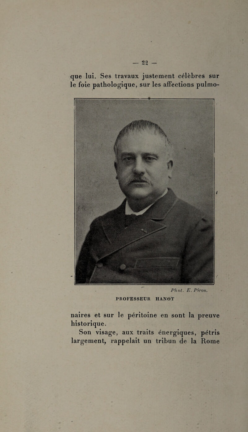 que lui. Ses travaux justement célèbres sur le foie pathologique, sur les affections pulmo- Phot. E. Pirou. PROFESSEUR HANOT naires et sur le péritoine en sont la preuve historique. Son visage, aux traits énergiques, pétris largement, rappelait un tribun de la Rome