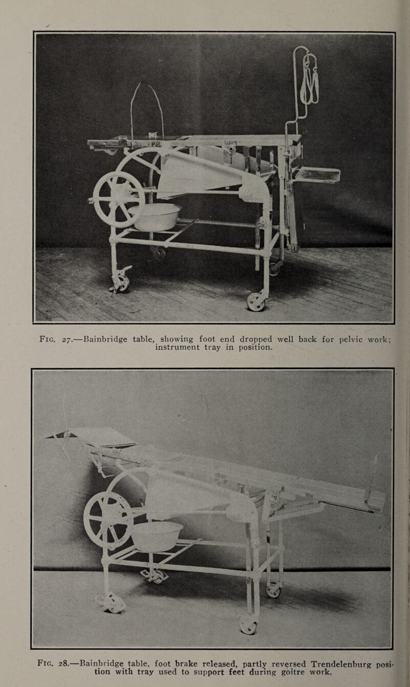 instrument tray in position. Fig. 28.—Bainbridge table, foot brake released, partly reversed Trendelenburg posi¬ tion with tray used to support feet during goitre work.