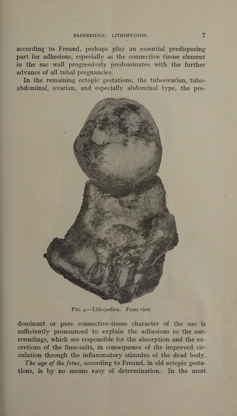 according to Freund, perhaps play an essential predisposing part for adhesions, especially as the connective tissue element in the sac wall progressively predominates with the further advance of all tubal pregnancies. In the remaining ectopic gestations, the tuboovarian, tubo- abdominal, ovarian, and especially abdominal type, the pre- Fig. 4.—Lithopedion. Front view. dominant or pure connective-tissue character of the sac is sufficiently pronounced to explain the adhesions to the sur¬ roundings, which are responsible for the absorption and the ex¬ cretions of the lime-salts, in consequence of the improved cir¬ culation through the inflammatory stimulus of the dead body. The age of the fetus, according to Freund, in old ectopic gesta¬ tions, is by no means easy of determination. In the most