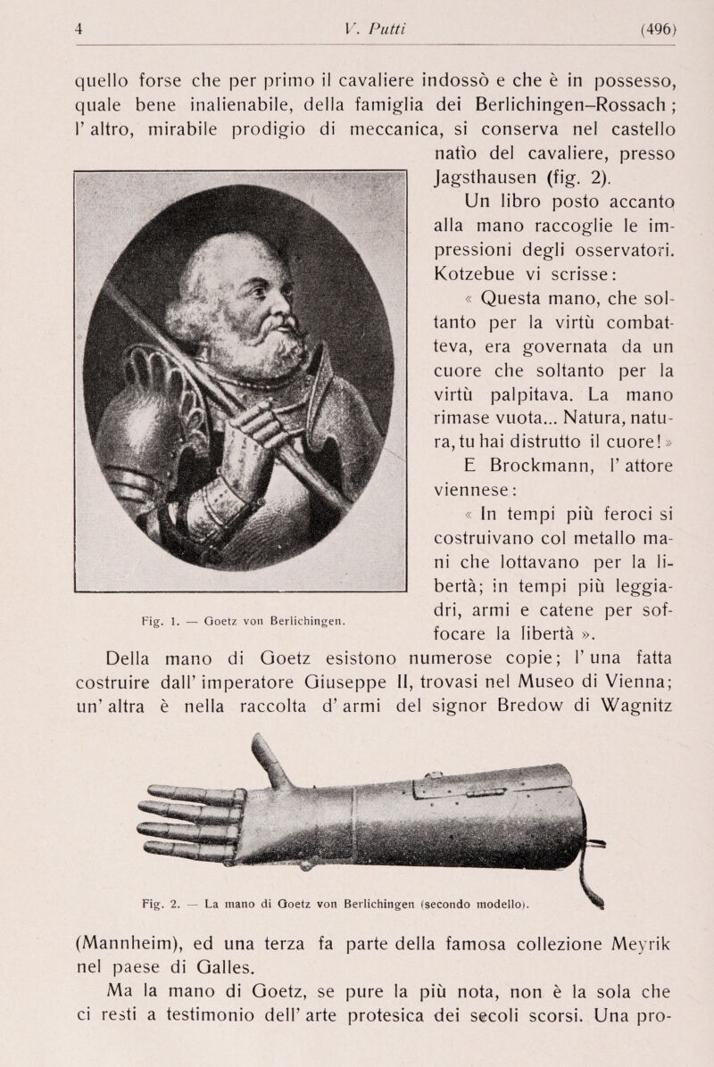 quello forse die per primo il cavalière indossô e die è in possesso, quale bene inalienabile, della famiglia dei Berlichingen-Rossach ; P altro, mirabile prodigio di meccanica, si conserva nel castello natïo del cavalière, presso jagsthausen (fig. 2). Un libro posto accanto alla mano raccoglie le im¬ pression! deglî osservatori. Kotzebue vi scrisse : « Questa mano, che sol- tanto per la virtù cornbat- teva, era governata da un cuore die soltanto per la virtù palpitava. La mano rimase vuota... Natura, natu- ra,tuhai distrutto il cuore!» E Brockmann, P attore Viennese : « In tempi più feroci si costruivano col métallo ma- ni che lottavano per la li¬ berté; in tempi più leggia- dri, armi e catene per sof- Fig. î. — Goetz von Berlichingen. focare la liberté ». Della mano di Goetz esistono numerose copie; Puna fatta costruire dall’ imperatore Giuseppe II, trovasi nel Museo di Vienna; un’ altra è nella raccoîta d’armi del signor Bredow di Wagnitz Fig. 2. — La mano di Goetz von Berlichingen (secondo modello). (Mannheim), ed una terza fa parte della famosa collezione Meyrik nel paese di Galles. Ma la mano di Goetz, se pure la più nota, non è la sola che ci resti a testimonio dell’ arte protesica dei secoli scorsi. Una pro-