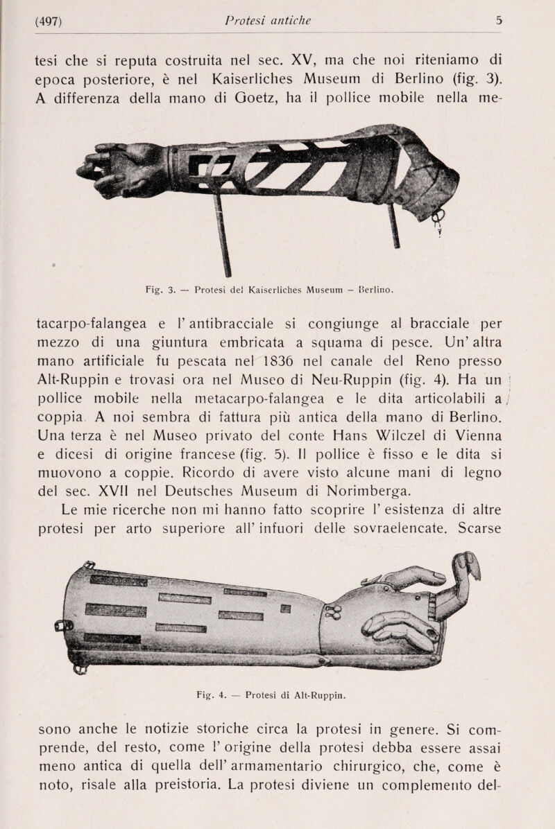 tesi die si reputa costruita nel sec. XV, ma die noi riteniamo di epoca posteriore, è nel Kaiserliches Museum di Berlino (fig. 3). A differenza della mano di Goetz, lia il pollice mobile nella me- Fig. 3. — Protesi del Kaiserliches Museum - Berlino. tacarpo-falangea e P antibracciale si congiunge al bracciale per mezzo di una giuntura embricata a squama di pesce. Un’ altra mano artificiale fu pescata nel 1836 nel canale del Reno presso Alt-Ruppin e trovasi ora nel Museo di Neu-Ruppin (fig. 4). Ha un pollice mobile nella metacarpo-falangea e le dita articolabili a coppia, A noi sembra di fattura più antica della mano di Berlino. Una terza è nel Museo privato del conte Hans Wilczel di Vienna e dicesi di origine francese (fig. 5). 11 pollice è fisso e le dita si muovono a coppie. Ricordo di avere visto alcune mani di legno del sec. XVII nel Deutsches Museum di Norimberga. Le mie ricerche non mi hanno fatto scoprire P esistenza di altre protesi per arto superiore all’ infuori delle sovraelencate. Scarse Fig. 4. — Protesi di Alt-Ruppin. sono anche le notizie storiche circa la protesi in genere. Si com prende, del resto, come !’ origine della protesi debba essere assai meno antica di quella dell’ armarnentario chirurgico, che, come è noto, risale alia preistoria. La protesi diviene un complemento del-