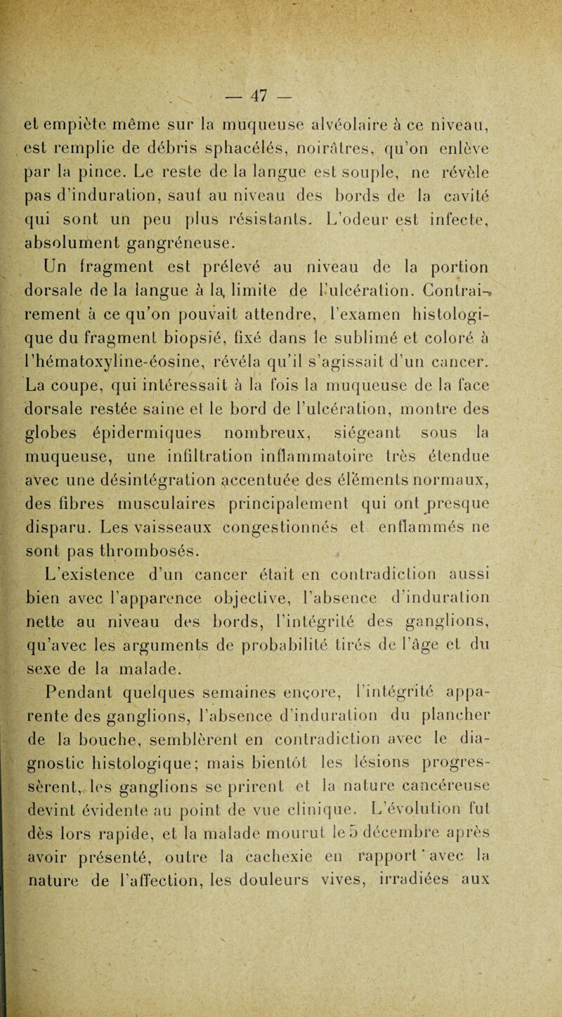 et empiète même sur la muqueuse alvéolaire à ce niveau, est remplie de débris sphacélés, noirâtres, qu’on enlève par la pince. Le reste de la langue est souple, ne révèle pas d’induration, sauf au niveau des bords de la cavité qui sont un peu plus résistants. L’odeur est infecte, absolument gangréneuse. Un fragment est prélevé au niveau de la portion dorsale de la langue à la, limite de l’ulcération. Contrai-» rement à ce qu’on pouvait attendre, l’examen histologi¬ que du fragment biopsié, fixé dans le sublimé et coloré à l’hématoxyline-éosine, révéla qu’il s’agissait d’un cancer. La coupe, qui intéressait à la fois la muqueuse de la face dorsale restée saine et le bord de l’ulcération, montre des globes épidermiques nombreux, siégeant sous la muqueuse, une infiltration inflammatoire très étendue avec une désintégration accentuée des éléments normaux, des fibres musculaires principalement qui ont presque disparu. Les vaisseaux congestionnés et enflammés ne sont pas thrombosés. L’existence d’un cancer était en contradiction aussi bien avec l’apparence objective, l’absence d’induration nette au niveau des bords, l’intégrité des ganglions, qu’avec les arguments de probabilité tirés de l âge et du sexe de la malade. Pendant quelques semaines encore, l’intégrité appa¬ rente des ganglions, l’absence d’induration du plancher de la bouche, semblèrent en contradiction avec le dia¬ gnostic histologique; mais bientôt les lésions progres¬ sèrent, les ganglions se prirent et la nature cancéreuse devint évidente au point de vue clinique. L’évolution fut dès lors rapide, et la malade mourut le 5 décembre après avoir présenté, outre la cachexie en rapport * avec la nature de l’affection, les douleurs vives, irradiées aux