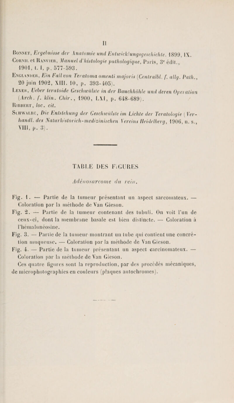 Bonnet, Ergebnisse dcr .\nalomie und Enlwicklungsgeschichle. 1899, l\. CoiiMi. et Uanvier, Manuel d'histologie pathologique, Paris, 3e édit., 1901, t. I, |>. 577-593. Englvnder, Ein Fallvon Teraloma omenli. majoris [Centralbl. f. allg. Patli., 20 juin 1902, XIII. 10, p. 393-405). Lexek, Ueber leraloide Geschwùlste in dcr Hauchhdhle und deren Operation (Arch. f. klin. Chir., 1900, LXI, p. 648-689). Bibbert, loc. cil. Schwalbe, Oie Enlslehung dcr Geschwùlste im Lichle dcr Tératologie [ Ver- handl. des Nalurhisloricli-medizinischen Vercins Heidelberg, 1906, n. s., VIII, p. 3). TABLE DES FIGURES /B/é/zo.sarcome <lu rein. Fig. I. — Partie de la tumeur présentant un aspect sarcomateux. — Coloration par la méthode de Van Gieson. Fig. 2. — Partie de la tumeur contenant des lubuli. On voit l’un de ceux-ci, dont la membrane basale est bien distincte. — Coloration à l’hémalunéosine. Fig. 3. — Pai iie de la tumeur montrant un tube qui contient une concré¬ tion muqueuse. — Coloration parla méthode de Van Gieson. Fig. 4. — Partie de la tumeur présentant un aspect carcinomateux. — Coloration par la méthode de Van Gieson. Ces quatre figures sont la reproduction, par des procédés mécaniques, de microphotographies en couleurs (plaques autochromes).