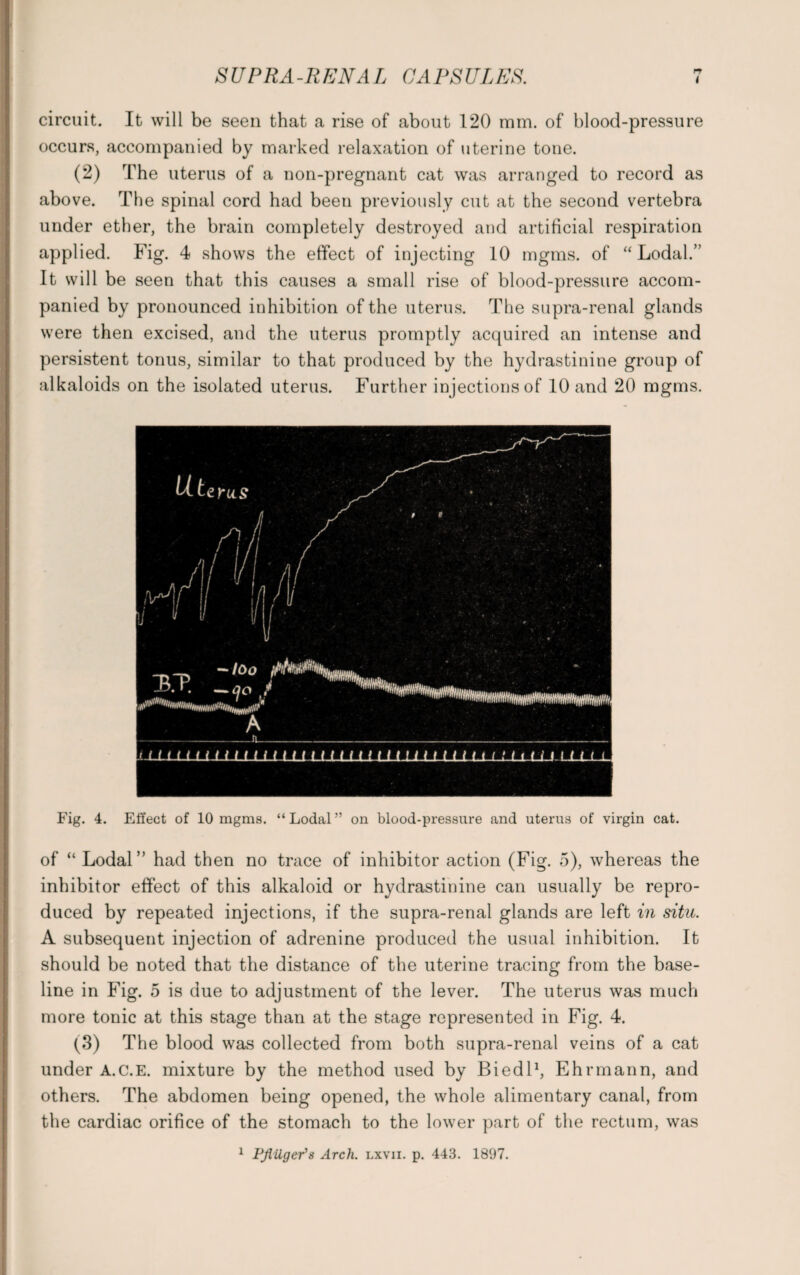 circuit. It will be seen that a rise of about 120 mm. of blood-pressure occurs, accompanied by marked relaxation of uterine tone. (2) The uterus of a non-pregnant cat was arranged to record as above. The spinal cord had beeu previously cut at the second vertebra under ether, the brain completely destroyed and artificial respiration applied. Fig. 4 shows the effect of injecting 10 mgms. of “ Lodal.” It will be seen that this causes a small rise of blood-pressure accom¬ panied by pronounced inhibition of the uterus. The supra-renal glands were then excised, and the uterus promptly acquired an intense and persistent tonus, similar to that produced by the hydrastinine group of alkaloids on the isolated uterus. Further injections of 10 and 20 mgms. Fig. 4. Effect of 10 mgms. “ Lodal ” on blood-pressure and uterus of virgin cat. of “ Lodal” had then no trace of inhibitor action (Fig. 5), whereas the inhibitor effect of this alkaloid or hydrastinine can usually be repro¬ duced by repeated injections, if the supra-renal glands are left in situ. A subsequent injection of adrenine produced the usual inhibition. It should be noted that the distance of the uterine tracing from the base¬ line in Fig. 5 is due to adjustment of the lever. The uterus was much more tonic at this stage than at the stage represented in Fig. 4. (3) The blood was collected from both supra-renal veins of a cat under A.C.E. mixture by the method used by Biedl1, Ehrmann, and others. The abdomen being opened, the whole alimentary canal, from the cardiac orifice of the stomach to the lower part of the rectum, was