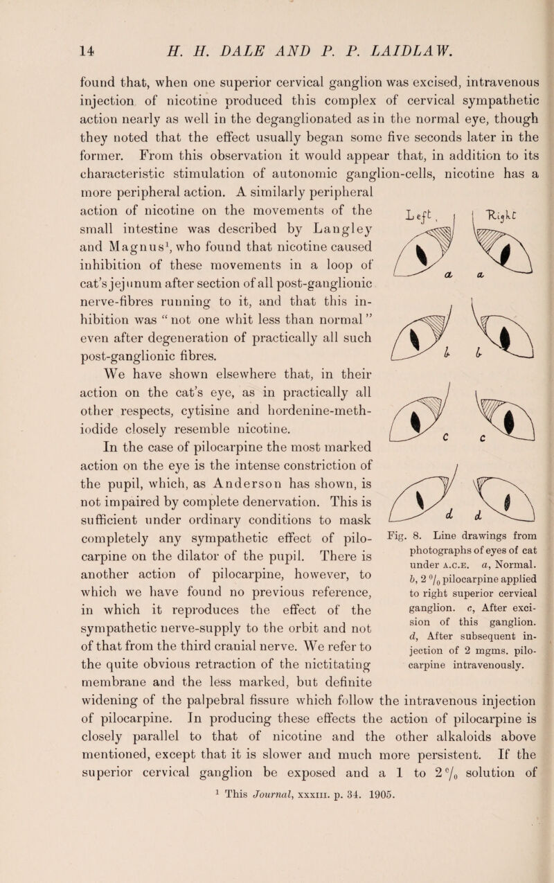 found that, when one superior cervical ganglion was excised, intravenous injection of nicotine produced this complex of cervical sympathetic action nearly as well in the deganglionated as in the normal eye, though they noted that the effect usually began some five seconds later in the former. From this observation it would appear that, in addition to its characteristic stimulation of autonomic ganglion-cells, nicotine has a more peripheral action. A similarly peripheral action of nicotine on the movements of the small intestine was described by Langley and Magnus1, who found that nicotine caused inhibition of these movements in a loop of cat’s jejunum after section of all post-ganglionic nerve-fibres running to it, and that this in¬ hibition was “not one whit less than normal” even after degeneration of practically all such post-ganglionic fibres. We have shown elsewhere that, in their action on the cat’s eye, as in practically all other respects, cytisine and hordenine-meth- iodide closely resemble nicotine. In the case of pilocarpine the most marked action on the eye is the intense constriction of the pupil, which, as Anderson has shown, is not impaired by complete denervation. This is sufficient under ordinary conditions to mask completely any sympathetic effect of pilo- FlS- carpine on the dilator of the pupil. There is another action of pilocarpine, however, to which we have found no previous reference, in which it reproduces the effect of the sympathetic nerve-supply to the orbit and not of that from the third cranial nerve. We refer to the quite obvious retraction of the nictitating membrane and the less marked, but definite widening of the palpebral fissure which follow the intravenous injection of pilocarpine. In producing these effects the action of pilocarpine is closely parallel to that of nicotine and the other alkaloids above mentioned, except that it is slower and much more persistent. If the superior cervical ganglion be exposed and a 1 to 2°/0 solution of 1 This Journal, xxxm. p. 34. 1905. 8. Line drawings from photographs of eyes of cat under a.c.e. a, Normal. b, 2 °/0 pilocarpine applied to right superior cervical ganglion, c, After exci¬ sion of this ganglion. d, After subsequent in¬ jection of 2 mgms. pilo¬ carpine intravenously.