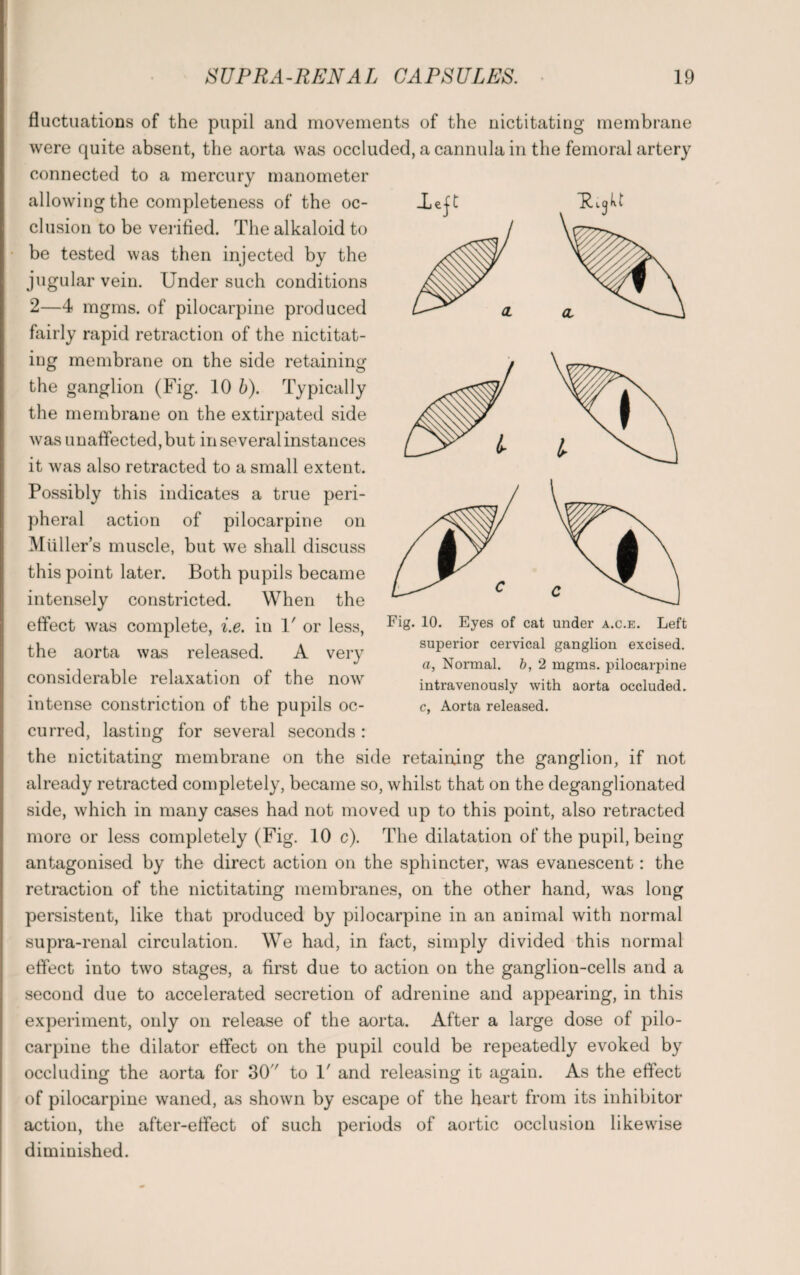 fluctuations of the pupil and movements of the nictitating membrane were quite absent, the aorta was occluded, a cannula in the femoral artery connected to a mercury manometer allowing the completeness of the oc¬ clusion to be verified. The alkaloid to be tested was then injected by the jugular vein. Under such conditions 2—4 mgms. of pilocarpine produced fairly rapid retraction of the nictitat¬ ing membrane on the side retaining the ganglion (Fig. 10 b). Typically the membrane on the extirpated side was unaffected, but in several instances it was also retracted to a small extent. Possibly this indicates a true peri¬ pheral action of pilocarpine on Muller’s muscle, but we shall discuss this point later. Both pupils became intensely constricted. When the effect was complete, i.e. in V or less, the aorta was released. A very considerable relaxation of the now intense constriction of the pupils oc¬ curred, lasting for several seconds: the nictitating membrane on the side retaining the ganglion, if not already retracted completely, became so, whilst that on the deganglionated side, which in many cases had not moved up to this point, also retracted more or less completely (Fig. 10 c). The dilatation of the pupil, being antagonised by the direct action on the sphincter, was evanescent: the retraction of the nictitating membranes, on the other hand, was long persistent, like that produced by pilocarpine in an animal with normal supra-renal circulation. We had, in fact, simply divided this normal effect into two stages, a first due to action on the ganglion-cells and a second due to accelerated secretion of adrenine and appearing, in this experiment, only on release of the aorta. After a large dose of pilo¬ carpine the dilator effect on the pupil could be repeatedly evoked by occluding the aorta for 30 to 1' and releasing it again. As the effect of pilocarpine waned, as shown by escape of the heart from its inhibitor action, the after-effect of such periods of aortic occlusion likewise diminished. Fig. 10. Eyes of cat under a.c.e. Left superior cervical ganglion excised, a, Normal, b, 2 mgms. pilocarpine intravenously with aorta occluded, c. Aorta released.