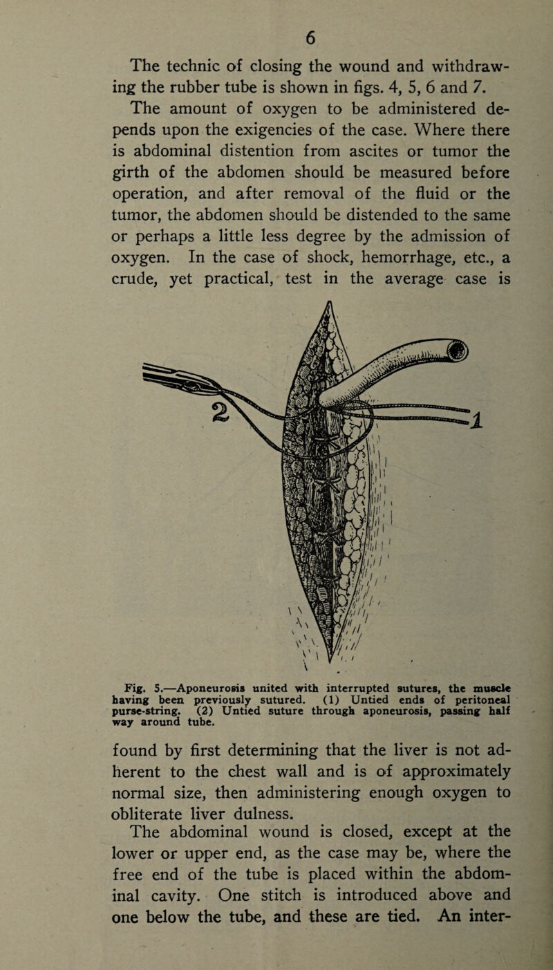 The technic of closing the wound and withdraw¬ ing the rubber tube is shown in figs. 4, 5, 6 and 7. The amount of oxygen to be administered de¬ pends upon the exigencies of the case. Where there is abdominal distention from ascites or tumor the girth of the abdomen should be measured before operation, and after removal of the fluid or the tumor, the abdomen should be distended to the same or perhaps a little less degree by the admission of oxygen. In the case of shock, hemorrhage, etc., a crude, yet practical, test in the average case is Fig. 5.—Aponeurosis united with interrupted sutures, the muscle having been previously sutured. (1) Untied ends of peritoneal purse-string. (2) Untied suture through aponeurosis, passing half way around tube. found by first determining that the liver is not ad¬ herent to the chest wall and is of approximately normal size, then administering enough oxygen to obliterate liver dulness. The abdominal wound is closed, except at the lower or upper end, as the case may be, where the free end of the tube is placed within the abdom¬ inal cavity. One stitch is introduced above and one below the tube, and these are tied. An inter-