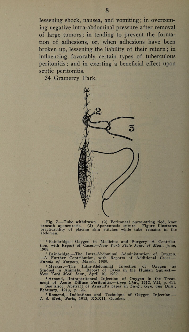 lessening shock, nausea, and vomiting; in overcom¬ ing negative intra-abdominal pressure after removal of large tumors; in tending to prevent the forma¬ tion of adhesions, or, when adhesions have been broken up, lessening the liability of their return; in influencing favorably certain types of tuberculous peritonitis; and in exerting a beneficial eflfect upon septic peritonitis. 34 Gramercy Park. Fig. 7.—Tube withdrawn. (2) Peritoneal purse-string tied, knot beneath aponeurosis. (3) Aponeurosis suture. Figure illustrates practicability of placing skin stitches while tube remains in the abdomen. 1 Bainbridge,—Oxygen in Medicine and Surgery—A Contribu¬ tion, with Report of Cases.—New York State Jour, of Med., June, 1908. 2 Bainbridge,—The Intra-Abdominal Administration of Oxygen, —A Further Contribution, with Reports of Additional Cases.— Annals of Surgery, March, 1909. 3 Meeker,—The Intra-Abdominal Injection of Oxygen as Studied in Animals. Report of Cases in the Human Subject.— New York Med. Jour., April 10, 1909. 4 Arnaud,—Intraperitoneal Injection of Oxygen in the Treat¬ ment of Acute Diffuse Peritonitis.—Lyon Chir., 1912, VII, p. 411. See also: Abstract of Arnaud’s paper in Surg., Gyn. and Obst., February, 1913, p. 23. B Raimond,—Indications and Technique of Oxygen Injection.— J. d. Med., Paris, 1912, XXXII, October.