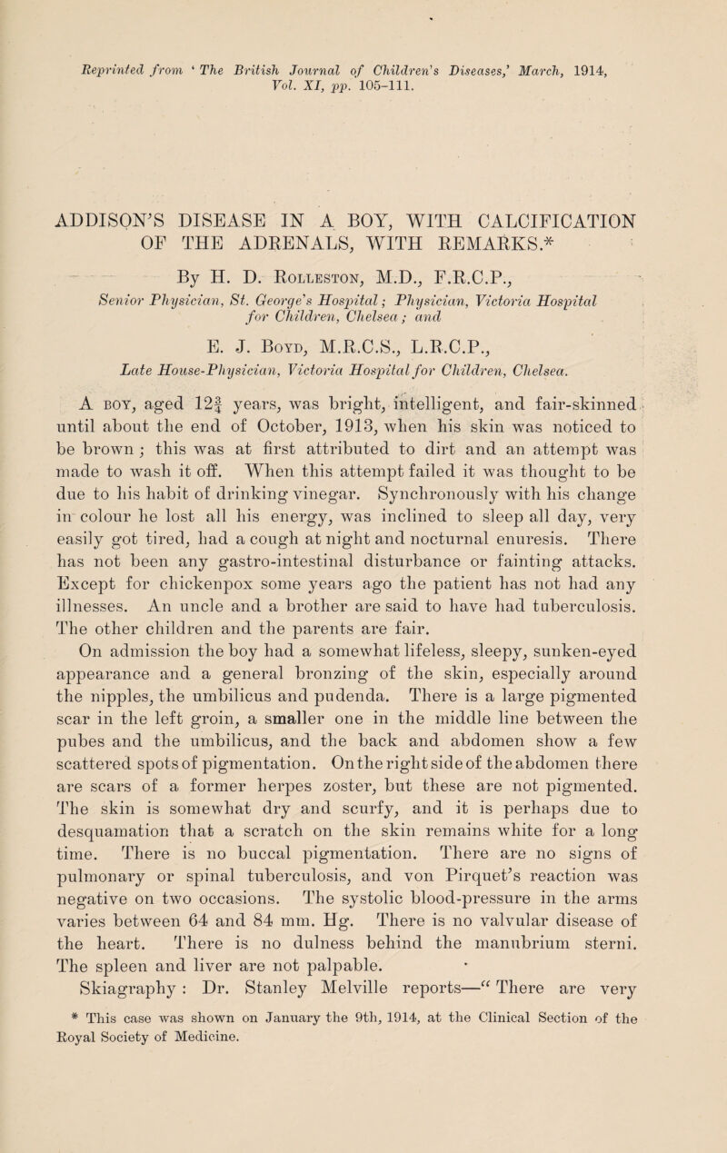 Reprinted from ‘ The British Journal of Children's Diseases,’ March, 1914, Vol. XI, pp. 105-111. ADDISON’S DISEASE IN A BOY, WITH CALCIFICATION OF THE ADRENALS, WITH REMARKS.* By H. D. Rolleston, M.D., F.R.C.P., Senior Physician, St. George's Hospital; Physician, Victoria Hospital for Children, Chelsea; and E. J. Boyd, M.R.C.S., L.R.C.P., Late House-Physician, Victoria Hospital for Children, Chelsea. A boy, aged 12| years, was bright, intelligent, and fair-skinned until about the end of October, 1918, when his skin was noticed to be brown ; this was at first attributed to dirt and an attempt was made to wash it off. When this attempt failed it was thought to be due to his habit of drinking vinegar. Synchronously with his change in colour he lost all his energy, was inclined to sleep all day, very easily got tired, had a cough at night and nocturnal enuresis. There has not been any gastro-intestinal disturbance or fainting attacks. Except for chickenpox some years ago the patient has not had any illnesses. An uncle and a brother are said to have had tuberculosis. The other children and the parents are fair. On admission the boy had a somewhat lifeless, sleepy, sunken-eyed appearance and a general bronzing of the skin, especially around the nipples, the umbilicus and pudenda. There is a large pigmented scar in the left groin, a smaller one in the middle line between the pubes and the umbilicus, and the back and abdomen show a few scattered spots of pigmentation. On the right side of theabdomen there are scars of a former herpes zoster, but these are not pigmented. The skin is somewhat dry and scurfy, and it is perhaps due to desquamation that a scratch on the skin remains white for a long time. There is no buccal pigmentation. There are no signs of pulmonary or spinal tuberculosis, and von Pirquet’s reaction was negative on two occasions. The systolic blood-pressure in the arms varies between 64 and 84 mm. Hg. There is no valvular disease of the heart. There is no dulness behind the manubrium sterni. The spleen and liver are not palpable. Skiagraphy : Dr. Stanley Melville reports—“ There are very * This case was shown on January the 9th, 1914, at the Clinical Section of the Royal Society of Medicine.