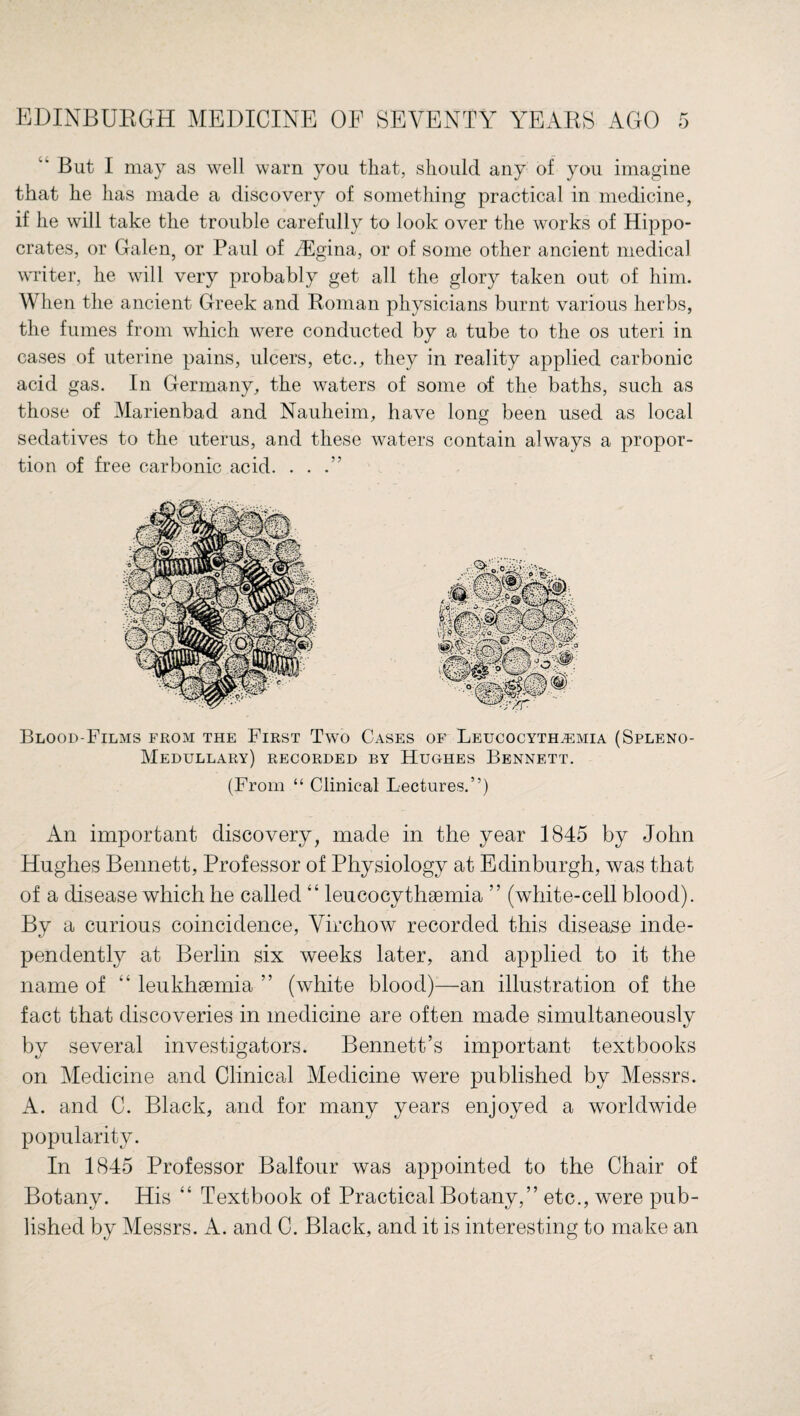 But I may as well warn you that, should any of you imagine that he has made a discovery of something practical in medicine, if he will take the trouble carefully to look over the works of Hippo¬ crates, or Galen, or Paul of HCgina, or of some other ancient medical writer, he will very probably get all the glory taken out of him. When the ancient Greek and Roman physicians burnt various herbs, the fumes from which were conducted by a tube to the os uteri in cases of uterine pains, ulcers, etc., they in reality applied carbonic acid gas. In Germany, the waters of some of the baths, such as those of Marienbad and Nauheim, have long been used as local sedatives to the uterus, and these waters contain always a propor¬ tion of free carbonic acid. . . Blood-Films from the First Two Cases of Leucocyth^mia (Spleno- Medullary) recorded by Hughes Bennett. (From “ Clinical Lectures.”) An important discovery, made in the year 1845 by John Hughes Bennett, Professor of Physiology at Edinburgh, was that of a disease which he called “ leucocythsemia ” (white-cell blood). By a curious coincidence, Virchow recorded this disease inde¬ pendently at Berlin six weeks later, and applied to it the name of “ leukhsemia ” (white blood)—an illustration of the fact that discoveries in medicine are often made simultaneously by several investigators. Bennett’s important textbooks on Medicine and Clinical Medicine were published by Messrs. A. and C. Black, and for many years enjoyed a worldwide popularity. In 1845 Professor Balfour was appointed to the Chair of Botany. His “ Textbook of Practical Botany,” etc., were pub¬ lished by Messrs. A. and C. Black, and it is interesting to make an