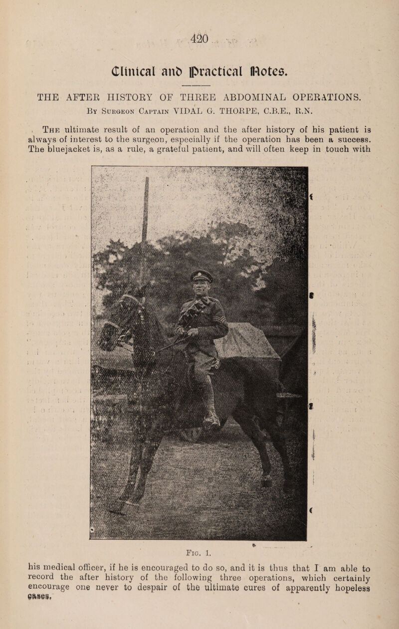 Clinical ant> practical IRotcs. THE AFTER HISTORY OF THREE ABDOMINAL OPERATIONS. By Surgeon Captain VIDAL G. THORPE, C.B.E., R.N. , The ultimate result of an operation and the after history of his patient is always of interest to the surgeon, especially if the operation has been a success. The bluejacket is, as a rule, a grateful patient, and will often keep in touch with Fig. 1. his medical officer, if he is encouraged to do so, and it is thus that I am able to record the after history of the following three operations, which certainly encourage one never to despair of the ultimate cures of apparently hopeless pases.