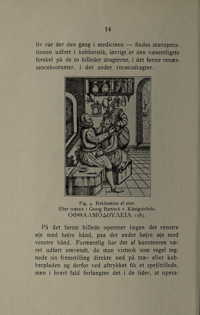 liv var der den gang i medicinen — findes stæropera¬ tionen udført i kobberstik, iøvrigt er den væsentligste forskel på de to billeder dragterne, i det første renæs¬ sancekostumer, i det andet rococodragter. Fig. 4. Reklination af stær. Efter træsnit i Georg Bartisch v. Konigsbriicks OO© A AMO AOYAEIA 1583. På det første billede opererer lægen det venstre øje med højre hånd, paa det andet højre øje med venstre hånd. Formentlig har det af kunstneren væ¬ ret udført omvendt, da man vistnok som regel teg¬ nede sin fremstilling direkte ned på træ- eller kob¬ berpladen og derfor ved aftrykket fik et spejlbillede, men i hvert fald forlangtes det i de tider, at opera-