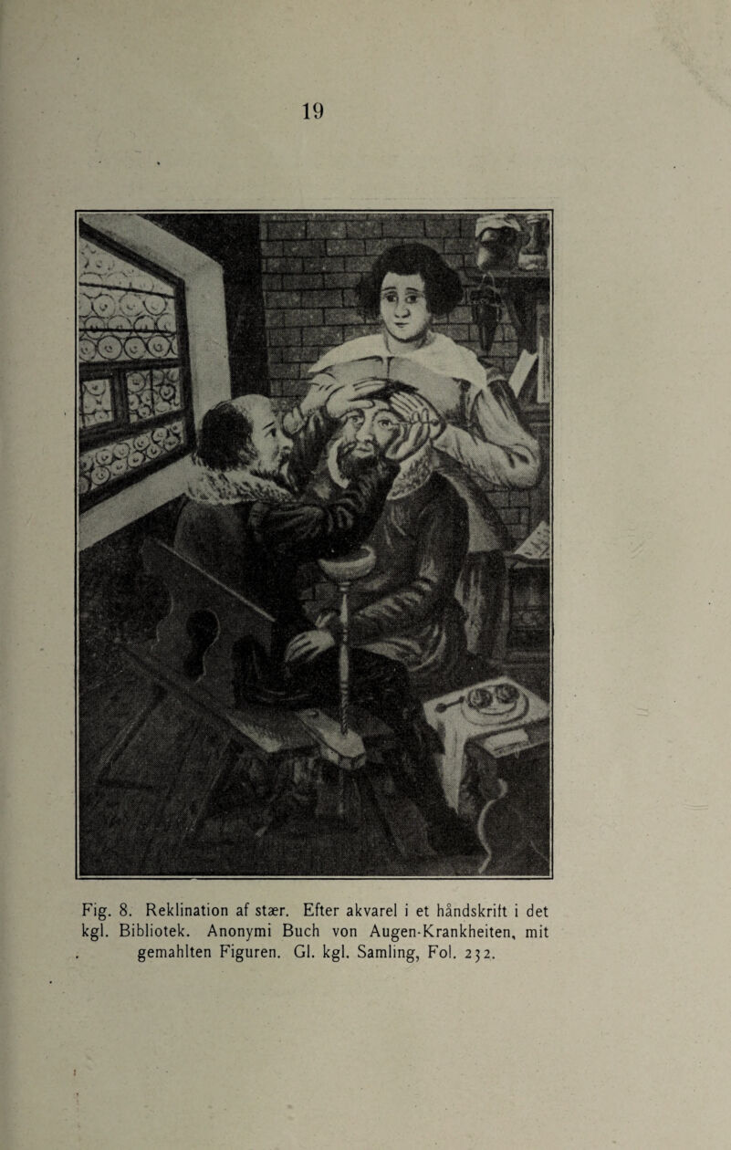 Fig. 8. Reklination af stær. Efter akvarel i et håndskrift i det kgl. Bibliotek. Anonymi Buch von Augen-Krankheiten, mit gemahlten Figuren. GI. kgl. Samling, Fol. 232. i