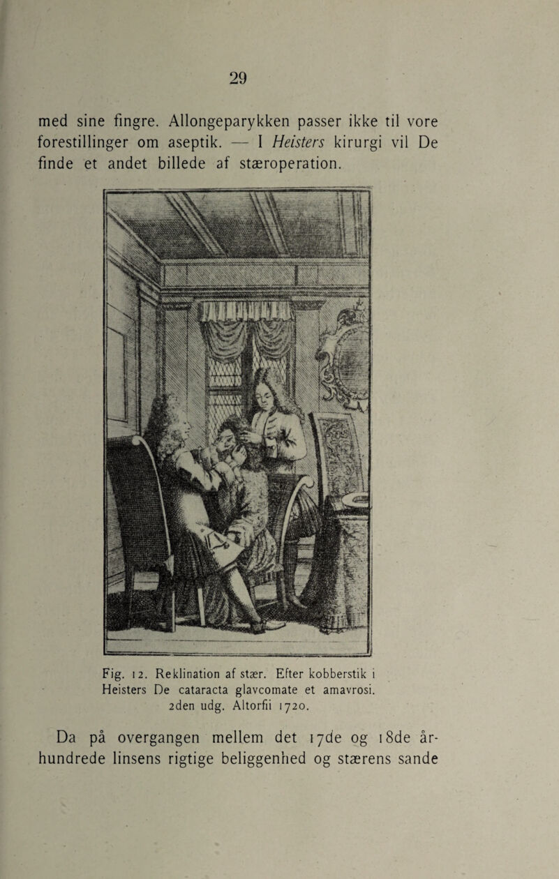 med sine fingre. Allongeparykken passer ikke til vore forestillinger om aseptik. — I Heisters kirurgi vil De finde et andet billede af stæroperation. Fig. 12. Reklination af stær. Efter kobberstik i Heisters De cataracta glavcomate et amavrosi. 2den udg. Altorfii 1720. Da på overgangen mellem det 17de og 18de år¬ hundrede linsens rigtige beliggenhed og stærens sande