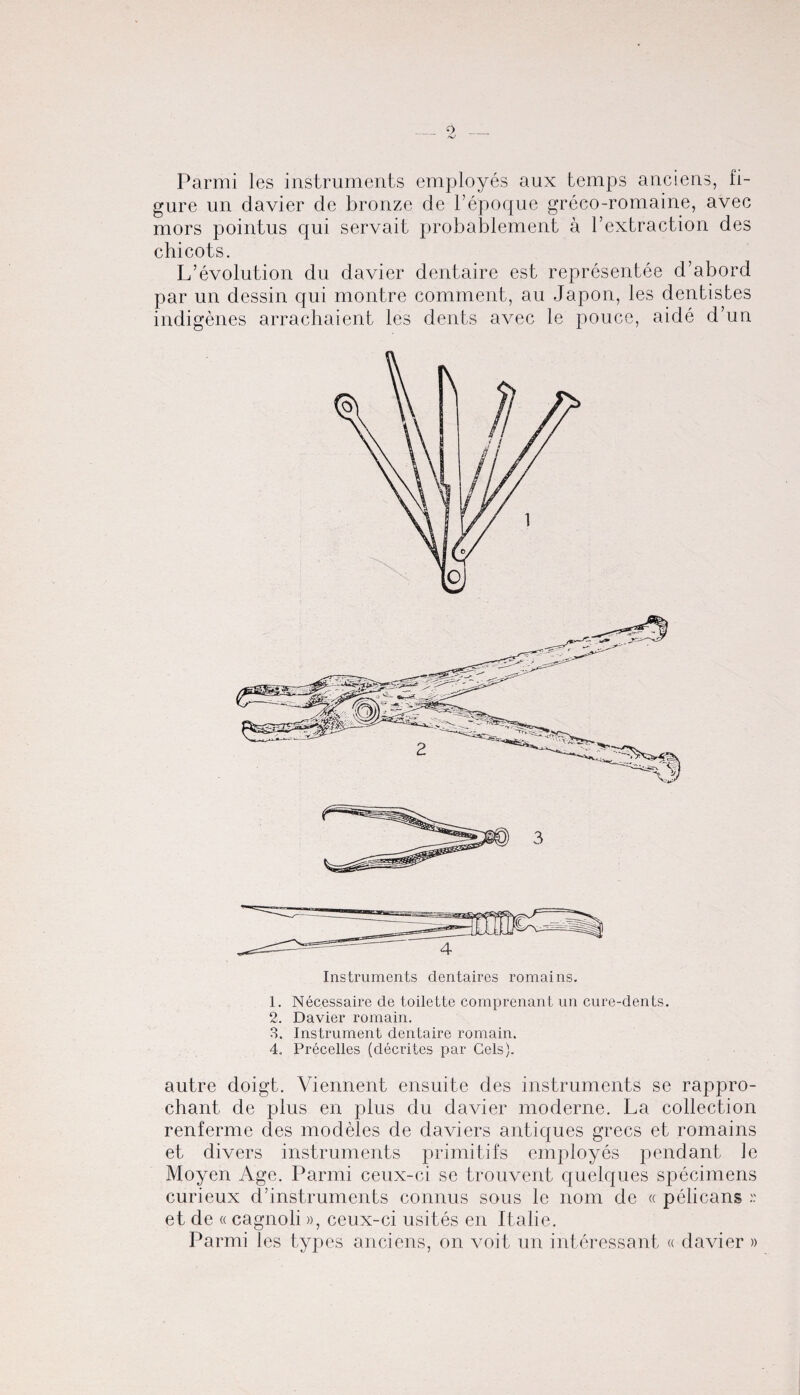 Parmi les instruments employes aux temps anciens, fi¬ gure un davier de bronze de l’epoque greco-romaine, avec mors pointus cjui servait probablement a l’extraction des chicots. L’evolution du davier dentaire est representee d’abord par un dessin qui montre comment, au Japon, les dentistes indigenes arrachaient les dents avec le pouce, aide d’un 3 Instruments dentaires romains. 1. Necessaire de toilette comprenant un cure-dents. 2. Davier romain. 3. Instrument dentaire romain. 4. Precedes (decrites par Cels). autre doigt. Viennent ensuite des instruments se rappro- chant de plus en plus du davier moderne. La collection renferme des modeles de daviers antiques grecs et romains et divers instruments primitifs employes pendant le Moyen Age. Parmi ceux-ci se trouvent quelques specimens curieux d’instruments connus sous le nom de « pelicans r et de «cagnoli», ceux-ci usites en Italie. Parmi les types anciens, on voit un interessant « davier »