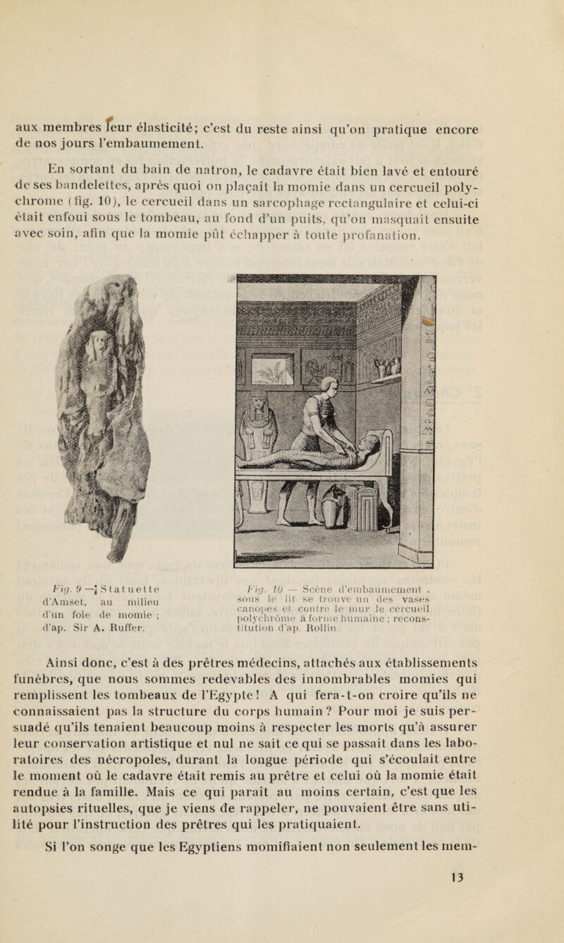 aux membres feur élasticité; c’est du reste ainsi qu’on j)ratique encore de nos jours l’embaumement. Ln sortant du bain de natron, le cadavre était bien lavé et entouré de ses bandelettes, après quoi on plaçait la momie dans un cercueil pol}'^- chronie ( lig. 10), le cercueil dans un sarcophage rectangulaire et celui-ci était enfoui sous le tombeau, au fond d’un puits, qu’on masquait ensuite avec soin, afin que la momie pfit cchap])er à toute î)rofanation. Firj. 9 —) S t a t U e 11 e d’Aiiiset, au milieu d'un foie de momie ; d’ap. Sir A. Ruffer. Fi;/, lu — Scène d’embaumemeid . sous le lit se trouve un des vases cano|ies et contre le mur le cercueil ]ml.ycl)rôm<i à forme humaine ; recons¬ titution d'ap. Rollin. Ainsi donc, c’est à des prêtres médecins, attachés aux établissements funèbres, que nous sommes redevables des innombrables momies qui remplissent les tombeaux de l’Egypte! A qui fera-t-on croire qu’ils ne connaissaient pas la structure du corps humain ? Pour moi je suis per¬ suadé qu’ils tenaient beaucoup moins à respecter les morts qu’à assurer leur conservation artistique et nul ne sait ce qui se passait dans les labo¬ ratoires des nécropoles, durant la longue période qui s’écoulait entre le moment où le cadavre était remis au prêtre et celui où la momie était rendue à la famille. Mais ce qui paraît au moins certain, c’est que les autopsies rituelles, que je viens de rappeler, ne pouvaient être sans uti¬ lité pour l’instruction des prêtres qui les pratiquaient. Si l’on songe que les Egyptiens momifiaient non seulement les mem-