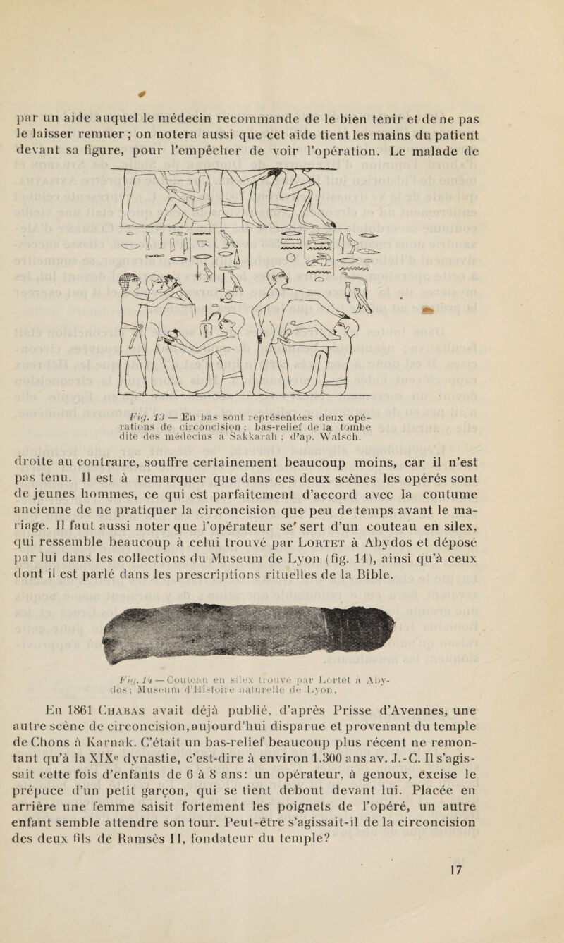 ])ar un aide auquel le médecin recommande de le bien tenir et de ne pas le laisser remuer; on notera aussi que cet aide tient les mains du patient devant sa ligure, pour l’empêcher de voir l’opération. Le malade de Fig. 13 — En bas sont représentées deux opé¬ rations de circoncision ; bas-relief de la tombe dite des médecins à Sakkarah ; d’ap. Walsch. droite au contraire, souffre certainement beaucoup moins, car il n’est pas tenu. Il est à remarquer que dans ces deux scènes les opérés sont de jeunes hommes, ce qui est parfaitement d’accord avec la coutume ancienne de ne pratiquer la circoncision que peu de temps avant le ma¬ riage. Il faut aussi noter que l’opérateur se sert d’un couteau en silex, qui ressemble beaucoup à celui trouvé par Lortet à Abydos et déposé par lui dans les collections du Muséum de L3'On (fig. 14), ainsi qu’à ceux dont il est parlé dans les prescriptions rituelles de la Bible. Fig.lk—Gonicjui en silex tiouvé par Loidet à Ab\- dos; Muséum d’ilistoire naturelle de I.yon. En 1861 ('.BABAS avait déjà publié, d’après Prisse d’Avennes, une autre scène de circoncision,aujourd’hui disparue et provenant du temple dédions à Karnak. C’était un bas-relief beaucoup plus récent ne remon¬ tant ({u’à la XIXc d^uiastie, c’est-dire à environ 1.300 ans av. J.-C. Il s’agis¬ sait cette fois d’enfants de 6 à 8 ans: un opérateur, à genoux, excise le prépuce d’un petit garçon, qui se tient debout devant lui. Placée en arrière une femme saisit fortement les poignets de l’opéré, un autre enfant semble attendre son tour. Peut-être s’agissait-il de la circoncision des deux fils de Ramsès II, fondateur du temple?