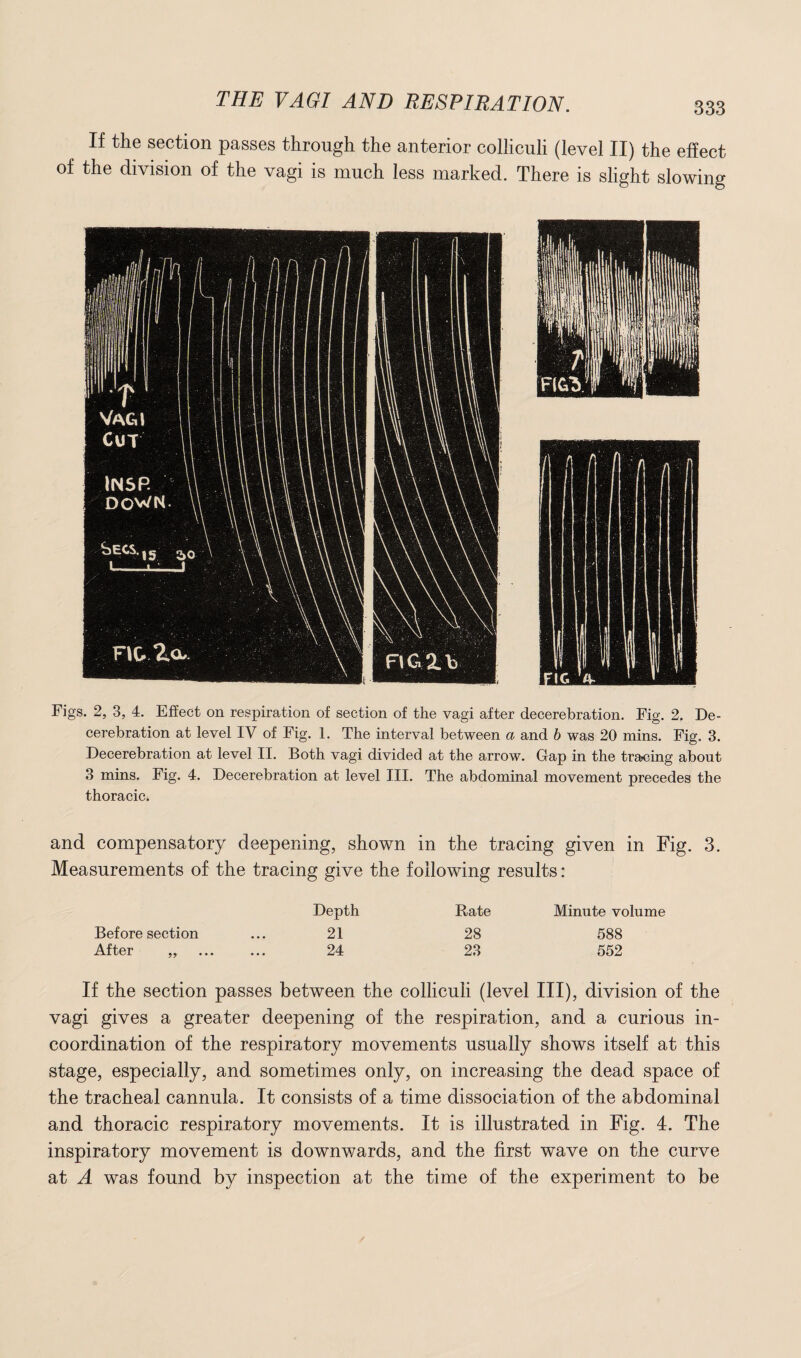 If the section passes through the anterior colliculi (level II) the effect of the division of the vagi is much less marked. There is slight slowing Figs. 2, 3, 4. Effect on respiration of section of the vagi after decerebration. Fig. 2. De¬ cerebration at level IV of Fig. 1. The interval between a and b was 20 mins. Fig. 3. Decerebration at level II. Both vagi divided at the arrow. Gap in the tracing about 3 mins. Fig. 4. Decerebration at level III. The abdominal movement precedes the thoracic. and compensatory deepening, shown in the tracing given in Fig. 3. Measurements of the tracing give the following results : Depth Rate Minute volume Before section ... 21 28 588 After „ . 24 23 552 If the section passes between the colliculi (level III), division of the vagi gives a greater deepening of the respiration, and a curious in¬ coordination of the respiratory movements usually shows itself at this stage, especially, and sometimes only, on increasing the dead space of the tracheal cannula. It consists of a time dissociation of the abdominal and thoracic respiratory movements. It is illustrated in Fig. 4. The inspiratory movement is downwards, and the first wave on the curve at A was found by inspection at the time of the experiment to be