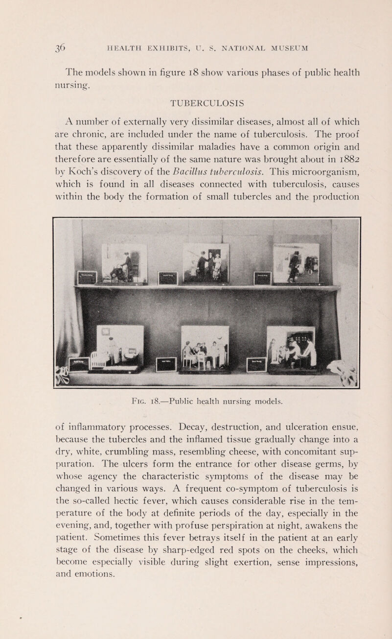 The models shown in figure 18 show various phases of public health nursing. TUBERCULOSIS A number of externally very dissimilar diseases, almost all of which are chronic, are included under the name of tuberculosis. The proof that these apparently dissimilar maladies have a common origin and therefore are essentially of the same nature was brought about in 1882 by Koch’s discovery of the Bacillus tuberculosis. This microorganism, which is found in all diseases connected with tuberculosis, causes within the body the formation of small tubercles and the production Fig. 18.—Public health nursing models. of inflammatory processes. Decay, destruction, and ulceration ensue, because the tubercles and the inflamed tissue gradually change into a dry, white, crumbling mass, resembling cheese, with concomitant sup¬ puration. The ulcers form the entrance for other disease germs, by whose agency the characteristic symptoms of the disease may be changed in various ways. A frequent co-symptom of tuberculosis is the so-called hectic fever, which causes considerable rise in the tem¬ perature of the body at definite periods of the day, especially in the evening, and, together with profuse perspiration at night, awakens the patient. Sometimes this fever betrays itself in the patient at an early stage of the disease by sharp-edged red spots on the cheeks, which become especially visible during slight exertion, sense impressions, and emotions.