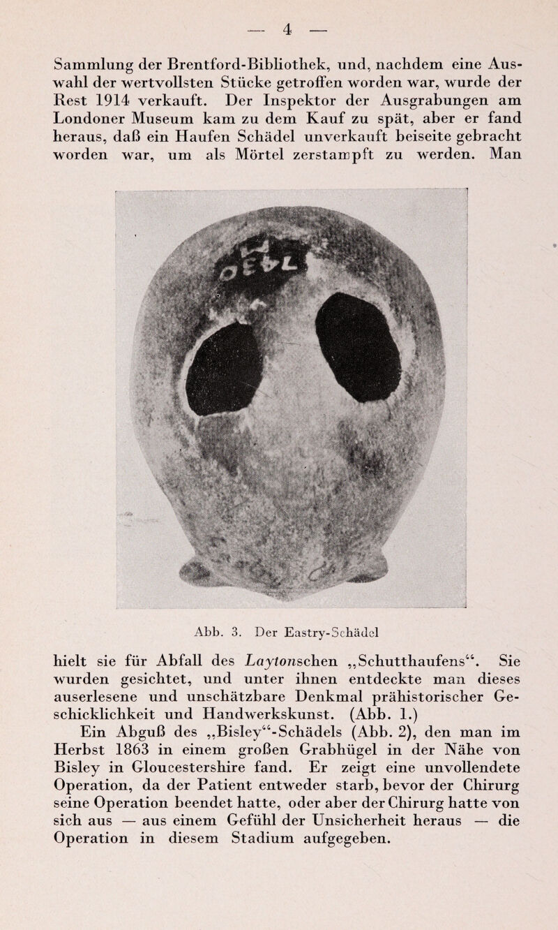 Sammlung der Brentford-Bibliothek, und, nachdem eine Aus- wahl der wertvollsten Stiicke getroffen worden war, wurde der Rest 1914 verkauft. Der Inspektor der Ausgrabungen am Londoner Museum kam zu dem Kauf zu spat, aber er fand heraus, daB ein Haufen Schadel unverkauft beiseite gebracht worden war, um als Mortel zerstampft zu werden. Man Abb. 3. Der Eastry-Schadel hielt sie fur Abfall des Laytojischen ,,Schutthaufens44. Sie wurden gesichtet, und unter ihnen entdeckte man dieses auserlesene und unschatzbare Denkmal prahistorischer Ge- schicklichkeit und Handwerkskunst. (Abb. 1.) Ein AbguB des ,,Bisley44-Schadels (Abb. 2), den man im Herbst 1863 in einem groBen Grabhiigel in der Nahe von Bisley in Gloucestershire fand. Er zeigt eine unvollendete Operation, da der Patient entweder starb, bevor der Chirurg seine Operation beendet hatte, oder aber der Chirurg hatte von sich aus — aus einem Gefiihl der Unsicherheit heraus — die Operation in diesem Stadium aufgegeben.
