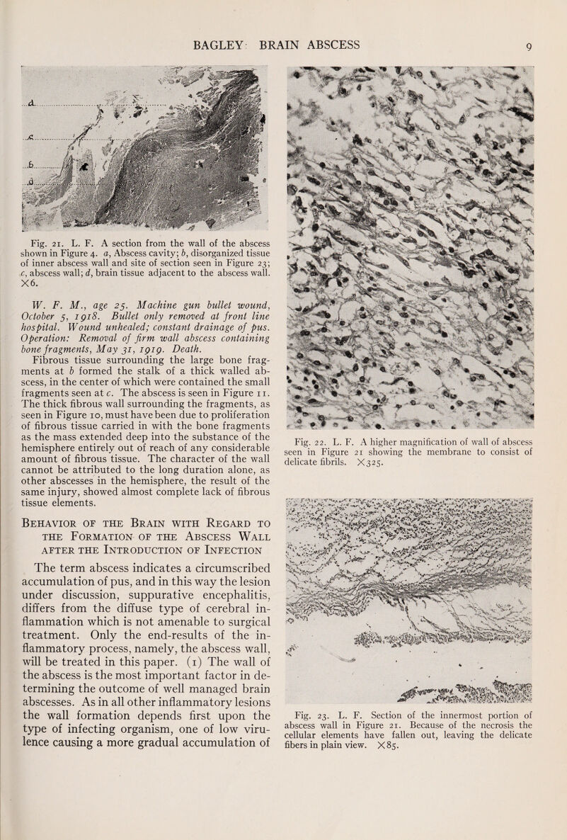 Fig. 21. L. F. A section from the wall of the abscess shown in Figure 4. a, Abscess cavity; b, disorganized tissue of inner abscess wall and site of section seen in Figure 23; c, abscess wall; d, brain tissue adjacent to the abscess wall. X6. W. F. M., age 23. Machine gun bullet wound, October 5, iqi8. Bullet only removed at front line hospital. Wound unhealed; constant drainage of pus. Operation: Removal of firm wall abscess containing bone fragments, May 31, 1919. Death. Fibrous tissue surrounding the large bone frag¬ ments at b formed the stalk of a thick walled ab¬ scess, in the center of which were contained the small fragments seen at c. The abscess is seen in Figure 11. The thick fibrous wall surrounding the fragments, as seen in Figure 10, must have been due to proliferation of fibrous tissue carried in with the bone fragments as the mass extended deep into the substance of the hemisphere entirely out of reach of any considerable amount of fibrous tissue. The character of the wall cannot be attributed to the long duration alone, as other abscesses in the hemisphere, the result of the same injury, showed almost complete lack of fibrous tissue elements. Behavior of the Brain with Regard to the Formation of the Abscess Wall AFTER THE INTRODUCTION OF INFECTION The term abscess indicates a circumscribed accumulation of pus, and in this way the lesion under discussion, suppurative encephalitis, differs from the diffuse type of cerebral in¬ flammation which is not amenable to surgical treatment. Only the end-results of the in¬ flammatory process, namely, the abscess wall, will be treated in this paper. (1) The wall of the abscess is the most important factor in de¬ termining the outcome of well managed brain abscesses. As in all other inflammatory lesions the wall formation depends first upon the type of infecting organism, one of low viru¬ lence causing a more gradual accumulation of Fig. 22. L. F. A higher magnification of wall of abscess seen in Figure 21 showing the membrane to consist of delicate fibrils. X325. Fig. 23. L. F. Section of the innermost portion of abscess wall in Figure 21. Because of the necrosis the cellular elements have fallen out, leaving the delicate fibers in plain view. X 85.