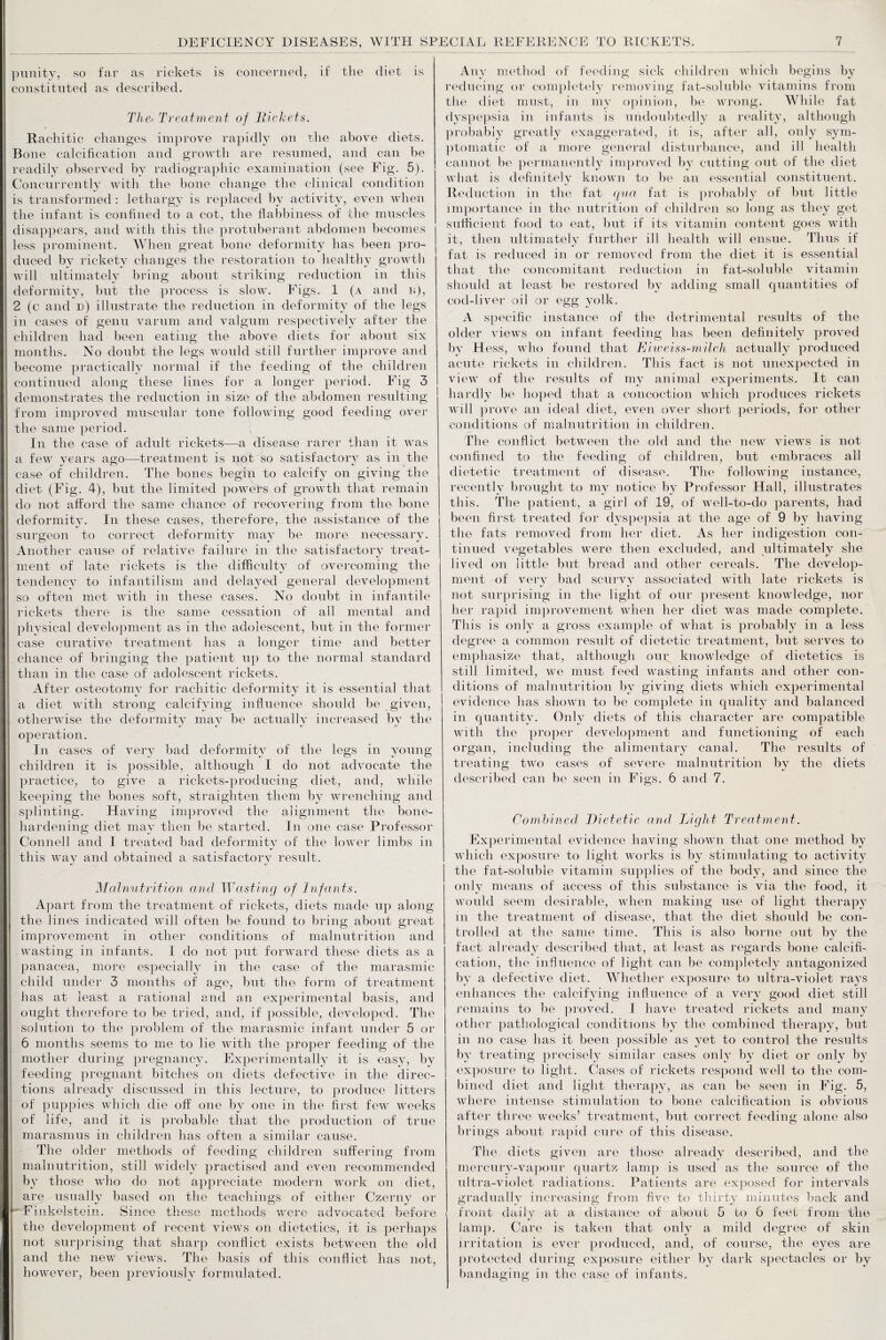 punity, so far as rickets is concerned, if the diet is constituted as described. The- Treatment of Rickets. Rachitic changes improve rapidly on the above diets. Bone calcification and growth are resumed, and can be readily observed by radiographic examination (see Fig. 5). Concurrently with the bone change the clinical condition is transformed : lethargy is replaced by activity, even when the infant is confined to a cot, the flabbiness of the muscles disappears, and with this the protuberant abdomen becomes less prominent. When great bone deformity has been pro¬ duced by rickety changes the restoration to healthy growth will ultimately bring about striking reduction in this deformity, but the process is slow. Figs. 1 (a and n), 2 (c and n) illustrate the reduction in deformity of the legs in cases of genu varum and valgum respectively after the children had been eating the above diets for about six months. No doubt the legs would still further improve and become practically normal if the feeding of the children continued along these lines for a longer period. Fig 3 demonstrates the reduction in size of the abdomen resulting from improved muscular tone following good feeding over the same period. In the case of adult rickets—a disease rarer than it was a few years ago—treatment is not so satisfactory as in the case of children. The bones begin to calcify on giving the diet (Fig. 4), but the limited powers of growth that remain do not afford the same chance of recovering from the bone deformity. In these cases, therefore, the assistance of the surgeon to correct deformity may be more necessary. Another cause of relative failure in the satisfactory treat¬ ment of late rickets is the difficulty of overcoming the tendency to infantilism and delayed general development so often met with in these cases. No doubt in infantile rickets there is the same cessation of all mental and physical development as in the adolescent, but in the former case curative treatment has a longer time and better chance of bringing the patient up to the normal standard than in the case of adolescent rickets. After osteotomy for rachitic deformity it is essential that a diet with strong calcifying influence should be given, otherwise the deformity may be actually increased by the operation. In cases of very bad deformity of the legs in young children it is possible, although I do not advocate the practice, to give a rickets-producing diet, and, while keeping the bones soft, straighten them by wrenching and splinting. Having improved the alignment the bone- hardening diet may then be started. In one case Professor Connell and I treated bad deformitv of the lower limbs in this way and obtained a satisfactory result. Malnutrition and Wasting of Infants. Apart from the treatment of rickets, diets made up along i the lines indicated will often be found to bring about great improvement in other conditions of malnutrition and wasting in infants. I do not put forward these diets as a panacea, more especially in the case of the marasmic child under 3 months of age, but the form of treatment has at least a rational and an experimental basis, and ought therefore to be tried, and, if possible, developed. The solution to the problem of the marasmic infant under 5 or 6 months seems to me to lie with the proper feeding of the mother during pregnancy. Experimentally it is easy, by feeding pregnant bitches on diets defective in the direc¬ tions already discussed in this lecture, to produce litters of puppies which die off one by one in the first few weeks of life, and it is probable that the production of true marasmus in children has often a similar cause. The older methods of feeding children suffering from malnutrition, still widely practised and even recommended by those who do not appreciate modern work on diet, are usually based on the teachings of either Czerny or Finkelstein. Since these methods were advocated before the development of recent views on dietetics, it is perhaps not surprising that sharp conflict exists between the old and the new views. The basis of this conflict has not, however, been previously formulated. Any method of feeding sick children which begins by reducing or completely removing fat-soluble vitamins from the diet must, in my opinion, be wrong. While fat dyspepsia in infants is undoubtedly a reality, although probably greatly exaggerated, it is, after all, only sym¬ ptomatic of a more general disturbance, and ill health cannot be permanently improved by cutting out of the diet what is definitely known to be an essential constituent. Reduction in the fat qua fat is probably of but little importance in the nutrition of children so long as they get sufficient food to eat, but if its vitamin content goes with it, then ultimately further ill health will ensue. Thus if fat is reduced in or removed from the diet it is essential that the concomitant reduction in fat-soluble vitamin should at least be restored by adding small quantities of cod-liver oil or egg yolk. A specific instance of the detrimental results of the older views on infant feeding has been definitely proved by Hess, who found that Ri weiss-milch actually produced acute rickets in children. This fact is not unexpected in view of the results of my animal experiments. It can hardly be hoped that a concoction which produces rickets will prove an ideal diet, even over short periods, for other conditions of malnutrition in children. The conflict between the old and the new views is not confined to the feeding of children, but embraces all dietetic treatment of disease. The following instance, recently brought to my notice by Professor Hall, illustrates this. The patient, a girl of 19, of well-to-do parents, had been first treated for dyspepsia at the age of 9 by having the fats removed from her diet. As her indigestion con¬ tinued vegetables were then excluded, and ultimately she lived on little but bread and other cereals. The develop¬ ment of very bad scurvy associated with late rickets is not surprising in the light of our present knowledge, nor her rapid improvement when her diet was made complete. This is only a gross example of what is probably in a less degree a common result of dietetic treatment, but serves to emphasize that, although our knowledge of dietetics is still limited, we must feed wasting infants and other con¬ ditions of malnutrition by giving diets which experimental evidence has shown to be complete in quality and balanced in quantity. Only diets of this character are compatible with the proper development and functioning of each organ, including the alimentary canal. The results of treating two cases of severe malnutrition by the diets described can be seen in Figs. 6 and 7. Combined Dietetic and Light Treatment. Experimental evidence having shown that one method by which exposure to light works is by stimulating to activity the fat-soluble vitamin supplies of the body, and since the only means of access of this substance is via the food, it would seem desirable, when making use of light therapy m the treatment of disease, that the diet should be con¬ trolled at the same time. This is also borne out by the fact already described that, at least as regards bone calcifi¬ cation, the influence of light can be completely antagonized by a defective diet. Whether exposure to ultra-violet rays enhances the calcifying influence of a very good diet still remains to be proved. I have treated rickets and many other pathological conditions by the combined therapy, but in no case has it been possible as yet to control the results by treating precisely similar cases only by diet or only by exposure to light. Cases of rickets respond well to the com¬ bined diet and light therapy, as can be seen in Fig. 5, where intense stimulation to bone calcification is obvious after three weeks’ treatment, but correct feeding alone also brings about rapid cure of this disease. The diets given are those already described, and the mercury-vapour quartz lamp is used as the source of the ultra-violet radiations. Patients are exposed for intervals gradually increasing from five to thirty minutes back and front daily at a distance of about 5 to 6 feet from the lamp. Care is taken that only a mild degree of skin irritation is ever produced, and, of course, the eyes are protected during exposure either by dark spectacles or by bandaging in the case of infants.