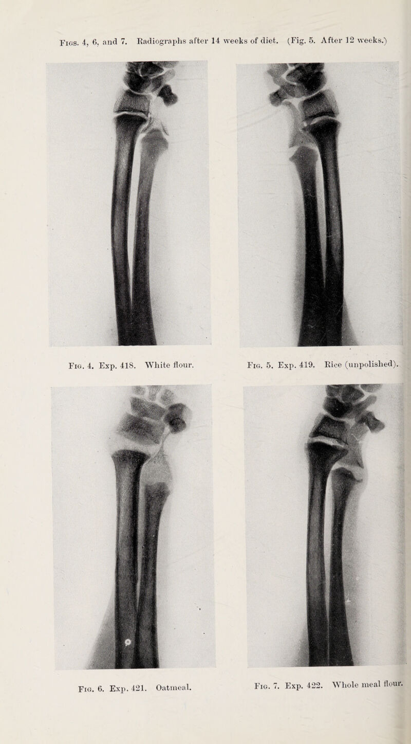 Fig. 4. Exp. 418. White flour. Fig. 6. Exp. 421. Oatmeal. Fig. 5. Exp. 419. Rice (unpolished). Fig. 7. Exp. 422. Whole meal flour.