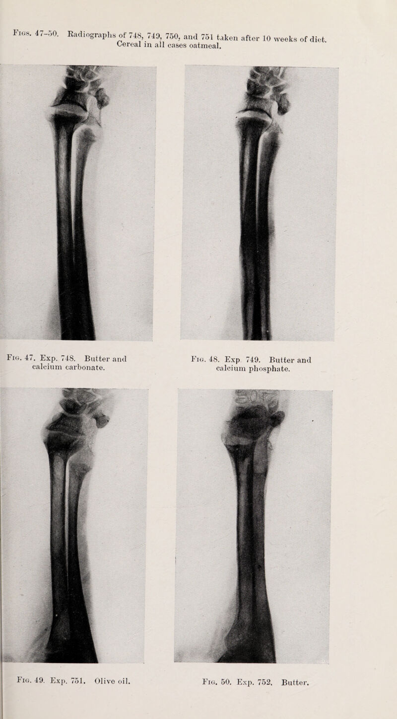 Figs. 47-50. Cereal in all cases oatmeal. Fig. 47. Exp. 748. Butter and calcium carbonate. Fig. 48. Exp 749. Butter and calcium phosphate. Fig. 49.