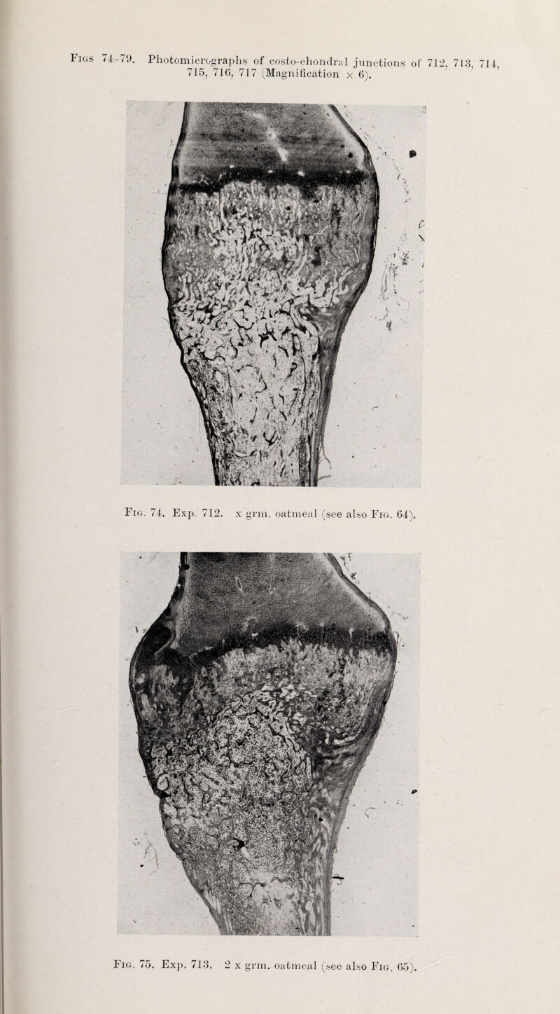 Figs 74-79. Photomicrographs of costo-chondn.il junctions of 712, 713 714 715, 716, 717 (Magnification x 6). Fig. 74. Exp. 712. x grm. oatmeal (see also Fig. 64).