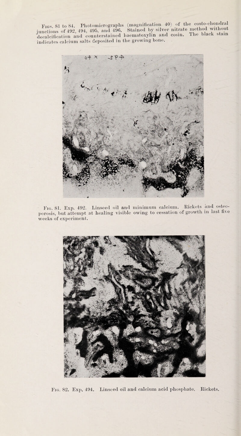 Figs 81 to 84. Photomicrographs (magnification 40) of the costo-chondial ■junctions of 492, 494, 495, and 496. Stained by silver nitrate method without decalcification and counterstained haematoxylin and cosin. the black stain indicates calcium salts deposited in the growing bone. Fig. 81. Exp. 492. Linseed oil and minimum calcium. Rickets and osteo¬ porosis, but attempt at healing visible owing to cessation of growth in last five weeks of experiment.