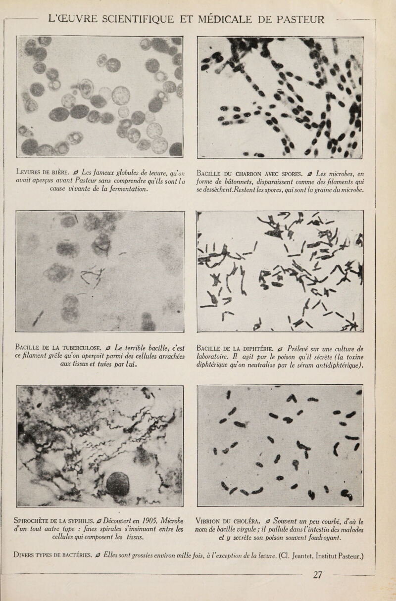 Levures de bière. 0 Les fameux globules de levure, quon avait aperçus avant Pasteur sans comprendre qu'ils sont la cause vivante de la fermentation. Bacille du charbon avec spores, 0 Les microbes, en forme de bâtonnets, disparaissent comme des filaments qui se dessèchent.Restent les spores, qui sont la graine du microbe. Bacille de la tuberculose. 0 Le terrible bacille, cest ce filament grêle qu'on aperçoit parmi des cellules arrachées aux tissus et tuées par lui. BACILLE DE la diphtérie. 0 Prélevé sur une culture de laboratoire. Il agit par le poison qu'il sécrète (la toxine diphtérique quon neutralise par le sérum antidiphtérique). Spirochète de la syphilis. 0 Découvert en 1905. Microbe d'un tout autre type : fines spirales s'insinuant entre les cellules qui composent les tissus. Vibrion du choléra. 0 Souvent un peu courbé, d’où le nom de bacille virgule ; il pullule dans P intestin des malades et y secrète son poison souvent foudroyant. DIVERS TYPES DE BACTÉRIES. 0 Elles sont grossies environ mille fois, à l'exception de la levure. (Cl. Jeantet, Institut Pasteur.)