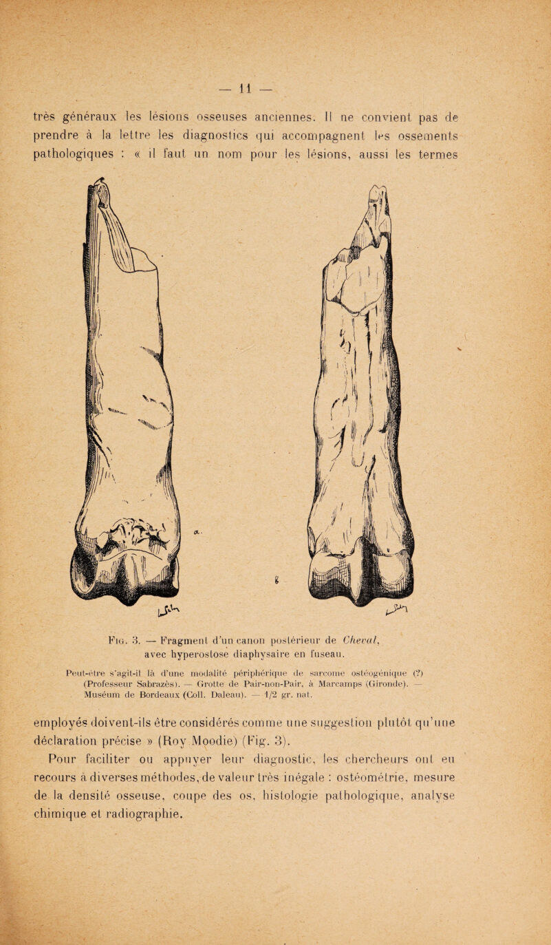 tres generaux les lesions ossenses anciennes. 11 ne convient pas de prendre a la lettre les diagnostics qui accompagnent les ossements pathologiqnes : cc d faut un nom pour les lesions, aussi les termes Fig. 3. — Fragment (Fun canon posterieur de Cheval, avec hyperostose diaphysaire en fuseau. Peut-etre s'agit-il la d’une rnodalite peripherique de sarcome osteogenique (?) (Professeur Sabrazes). — Grotte de Pair-non-Pair, a Marcarnps (Gironde). — Museum de Bordeaux (Coll. Daleau). — i/2 gr. nat. employes doivent-ils etre consideres cotmne line suggestion pin lot qu’une declaration precise » (Roy Moodie) (Fig. 3). Pour faciliter ou appuyer leur diagnostic, les chercheurs out eu recours a diverses methodes, de valeur tres inegale : osteometrie, mesure de la densite osseuse, coupe des os, histologie pathologique, analyse chimique et radiographie.
