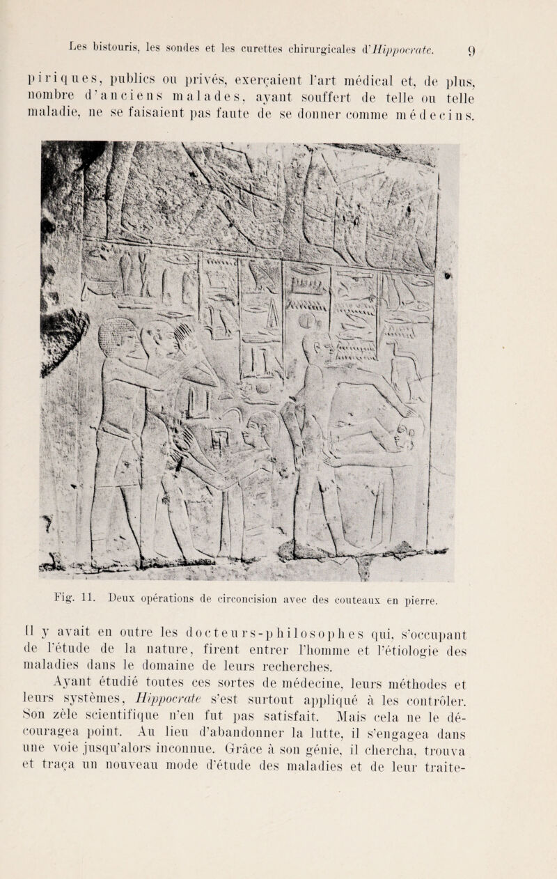 V.‘< ** xi- \H' ■'■'• \V %i' ‘ ■ Les bistouris, les sondes et les curettes chirurgicales d1 Hippocrate. 9 piriques, publics on prives, exercaient Part medical et, de plus, nombre d’anciens m a lades, ay ant souffert de telle on telle mala die, lie se faisaient pas laute de se donner comme medecins. Fig. 11. Deux operations de circoncision avec des couteaux en pierre. LI y avait, en outre les docteurs-philosophes qui, s’occupant de 1 etude de la nature, firent entrer Fliomme et Petiologie des maladies dans le domaine de leurs recherches. Ay ant etudie toutes ces sortes de medecine, leurs methodes et leurs systemes, Hippocrate s’est surtout applique a les controler. Son zele scientifique iFen fut pas satisfait. Mais cela ne le de- couragea point. An lieu d’abandonner la lutte, il s’engagea dans une voie jusqiFalors inconnue. Grace a son genie, il chercha, trouva et traca un nouveau mode d’etude des maladies et de leur traite-