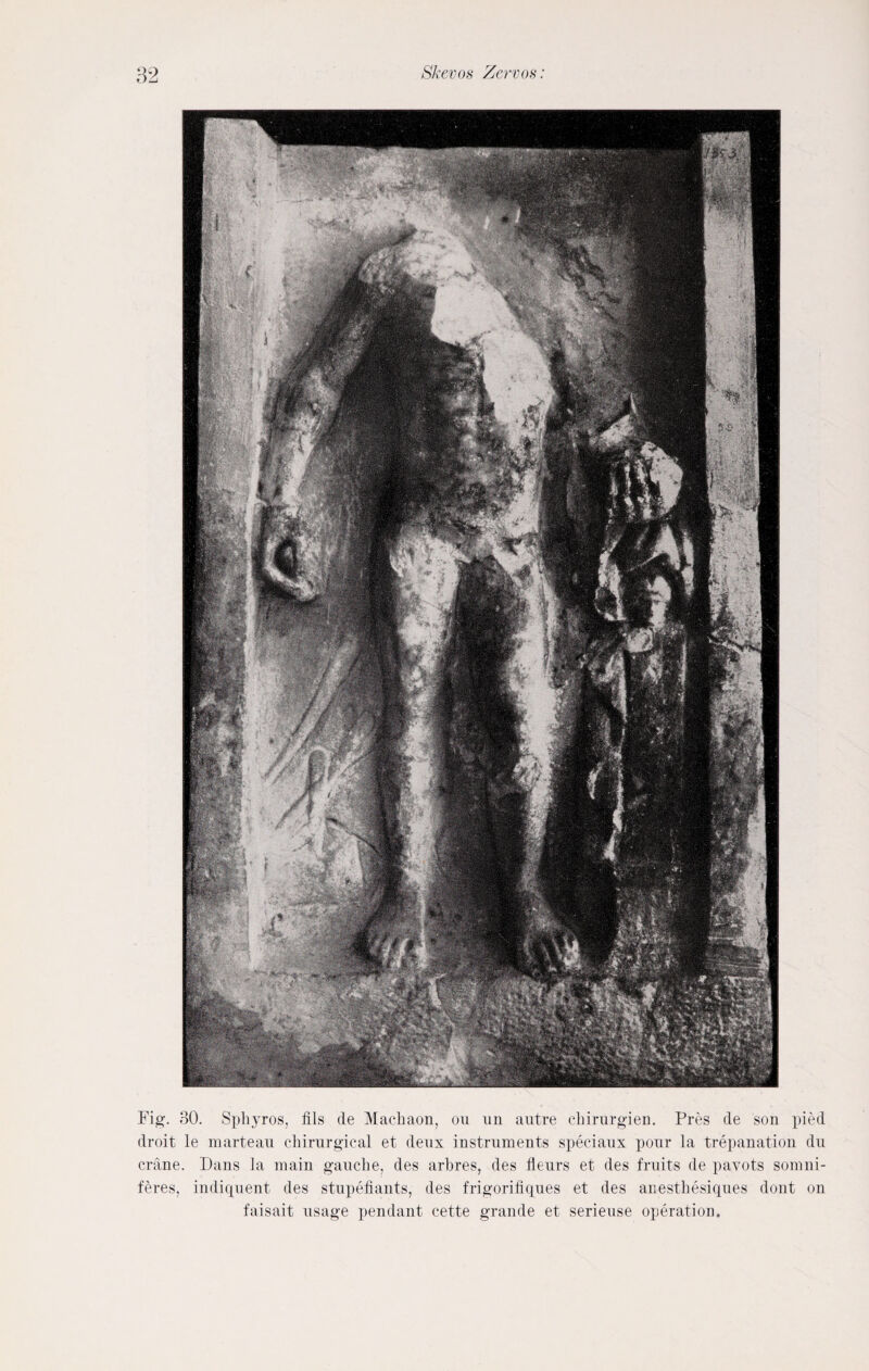 Fig. 30. Sphyros, fils de Mac-haon, ou un autre cliirurgien. Pres de son pied droit le marteau chirurgical et deux instruments speeiaux pour la trepanation du crane. Dans la main gauche, des arbres, des fleurs et des fruits de pavots somni- feres, indiquent des stupefiants, des frigorifiques et des anesthesiques dont on faisait usage pendant cette grande et serieuse operation.