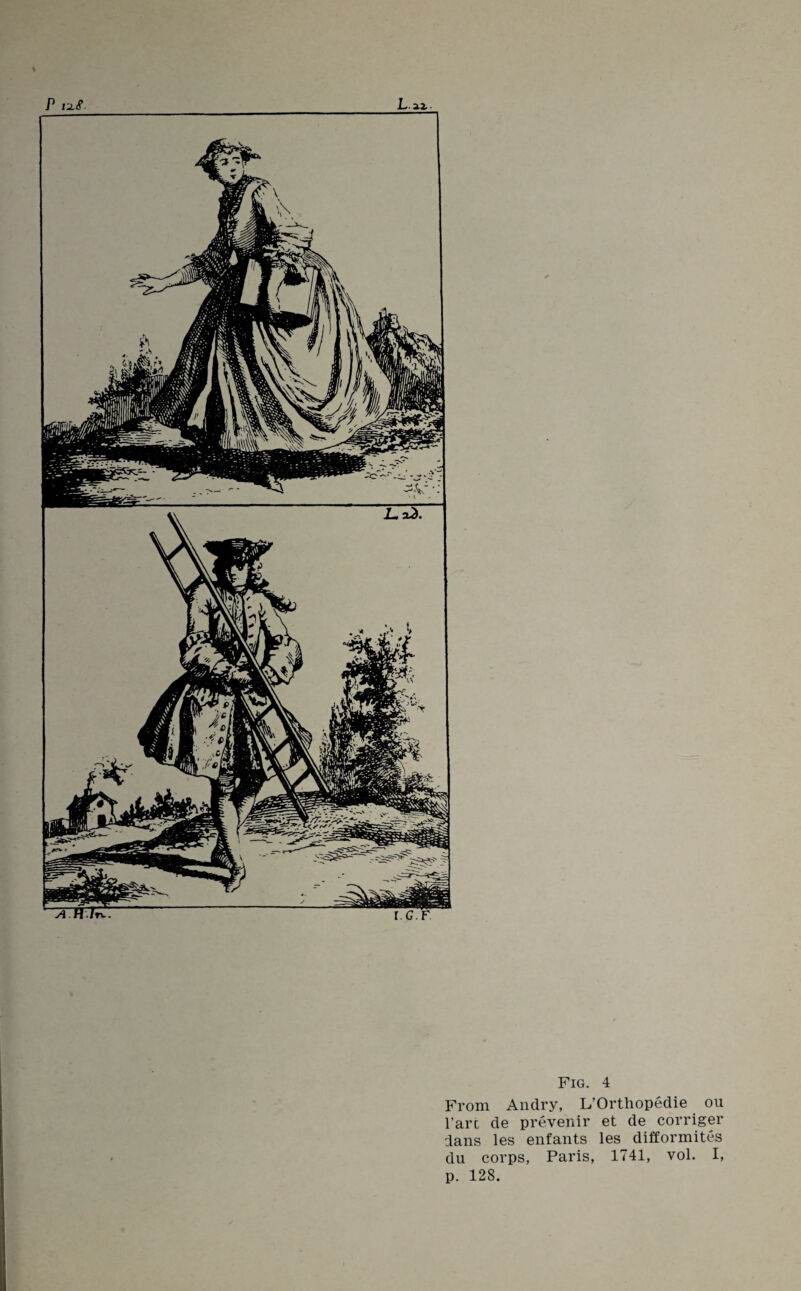 From Andry, L’Orthopedie ou l’arc de prevenir et de corriger dans les enfants les difformites du corps, Paris, 1741, vol. I, p. 128. I