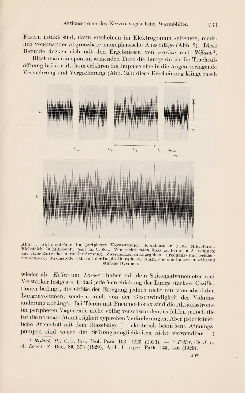 Fasern intakt sind, dann erscheinen im Elektrogramm seltenere, merk- lich voneinander abgrenzbare monophasische Ausschlage (Abb. 2). Diese Befunde decken sich mit den Ergebnissen von Adrian und Rijlant1. Blast man am spontan atmenden Tiere die Lunge durch die Tracheal- bffnung briisk auf, dann erfahren die Impulse eine in die Augen springende Vermehrung und VergroBerung (Abb. 3a); diese Erscheinung klingt rasch Abb. 1. Aktionsstrome im peripheren Vagusstumpf. Kondensator 0,005 Mikrofarad Eichstrich 20 Mikrovolt. Zeit in Vs Sek. Von rechts nach links zu lesen. a Ausschnitte aus emer Kurve bei normaler Atmung. Zwiscbenzeiten angegeben. Frequenz- und GrbBom zunahme der StromstoBe wahrend der Inspirationsphase. b Am Pneumothoraxtier wahrend starker Dyspnoe. wieder ab. Kallsr und Locssr 2 baben mit dem Saitengalvanometer und Verstarker festgestellt, daB jede Verscbiebung der Lunge starkere Oszilla- tionen bedingt, die GroBe der Erregung jedocb nicht nur vom absoluten Lungenvolumen, sondern auch von der Gesehwindigkeit der Volums- anderung abhangt. Bei Tieren mit Pneumothorax sind die Aktionsstrome im peripheren Vagusende nicht vollig verschwunden, es fehlen jedoch die fur die normale Atemtatigkeit typischen Veranderungen. Aber jeder kiinst- liche AtemstoB mit dem Blasebalge (— elektrisch betriebene Atmungs- pumpen sind wegen der Storungsmoglichkeiten nicht verwendbar —) 1 Rijlant, PC. r. Soc. Biol. Paris 112, 1225 (1933). — 2 Keller, Gh.J. u. A. Loeser: Z. Biol. 89, 373 (1929); Arch. f. exper. Path. 145, 146 (1929). 49*