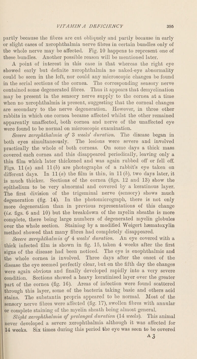 partly because the fibres are cut obliquely and partly because in early or slight cases of xerophthalmia nerve fibres in certain bundles only of the whole nerve may be affected. Fig. 10 happens to represent one of these bundles. Another possible reason will be mentioned later. A point of interest in this case is that whereas the right eye showed early but definite xerophthalmia no naked-eye abnormality could be seen in the left, nor could any microscopic changes be found in the serial sections of the cornea. The corresponding sensory nerve contained some degenerated fibres. Thus it appears that demyelination may be present in the sensory nerve supply to the cornea at a time when no xerophthalmia is present, suggesting that the corneal changes are secondary to the nerve degeneration. However, in three other rabbits in which one cornea became affected whilst the other remained apparently unaffected, both cornea and nerve of the unaffected eye were found to be normal on microscopic examination. Severe xerophthalmia of 3 weeks’ duration. The disease began in both eyes simultaneously. The lesions were severe and involved practically the whole of both corneas. On some days a thick mass covered each cornea and this disappeared periodically, leaving only a thin film which later thickened and was again rubbed off or fell off. Figs. 11(a) and 11(5) are photographs of a rabbit’s eye taken on different days. In 11(a) the film is thin, in 11(5), two days later, it is much thicker. Sections of the cornea (figs. 12 and 13) show the epithelium to be very abnornial and covered by a keratinous layer. The first division of the trigeminal nerve (sensory) shows much degeneration (fig. 14). In the photomicrograph, there is not only more degeneration than in previous representations of this change (i.e. figs. 6 and 10) but the breakdown of the myelin sheaths is more complete, there being large numbers of degenerated myelin globules over the whole section. Staining by a modified Weigert hsematoxylin method showed that many fibres had completely disappeared. Severe xerophthalmia of 4 weeks duration. An eye covered with a thick infected film is shown in fig. 15, taken 4 weeks after the first signs of the disease had been noticed. The eye is enophthalmic and the whole cornea is involved. Three days after the onset of the disease the eye seemed perfectly clear, but on the fifth day the changes were again obvious and finally developed rapidly into a very severe condition. Sections showed a heavy keratinisecl layer over the greater part of the cornea (fig. 16). Areas of infection were found scattered through this layer, some of the bacteria taking basic and others acid stains. The substantia propria appeared to be normal. Most of the sensory nerve fibres were affected (fig. 1*0? swollen fibres with annular or complete staining of the myelin sheath being almost general. Slight xerophthalmia of prolonged duration (14 weeks). This animal never developed a severe xerophthalmia although it was affected for 14 weeks. Six times during this period the eye was seen to be covered