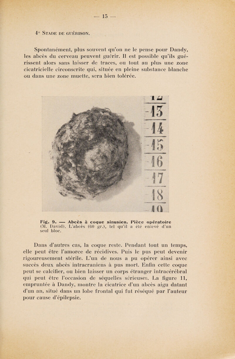 4° Stade de guérison. Spontanément, plus souvent qu’on ne le pense pour Dandy, les abcès du cerveau peuvent guérir. Il est possible qu’ils gué¬ rissent alors sans laisser de traces, ou tout au plus une zone cicatricielle circonscrite qui, située en pleine substance blanche ou dans une zone muette, sera bien tolérée. Fig. 9. — Abcès à coque sirausien. Pièce opératoire (M. David). L’abcès (GO gr.), tel qu’il a été enlevé d’un seul bloc. Dans d’autres cas, la coque reste. Pendant tout un temps, elle peut être l’amorce de récidives. Puis le pus peut devenir rigoureusement stérile. L’un de nous a pu opérer ainsi avec succès deux abcès intracrâniens à pus mort. Enfin cette coque peut se calcifier, ou bien laisser un corps étranger intracérébral qui peut être l’occasion de séquelles sérieuses. La figure 11, empruntée à Dandy, montre la cicatrice d’un abcès aigu datant d’un an, situé dans un lobe frontal qui fut réséqué par l’auteur pour cause d’épilepsie.