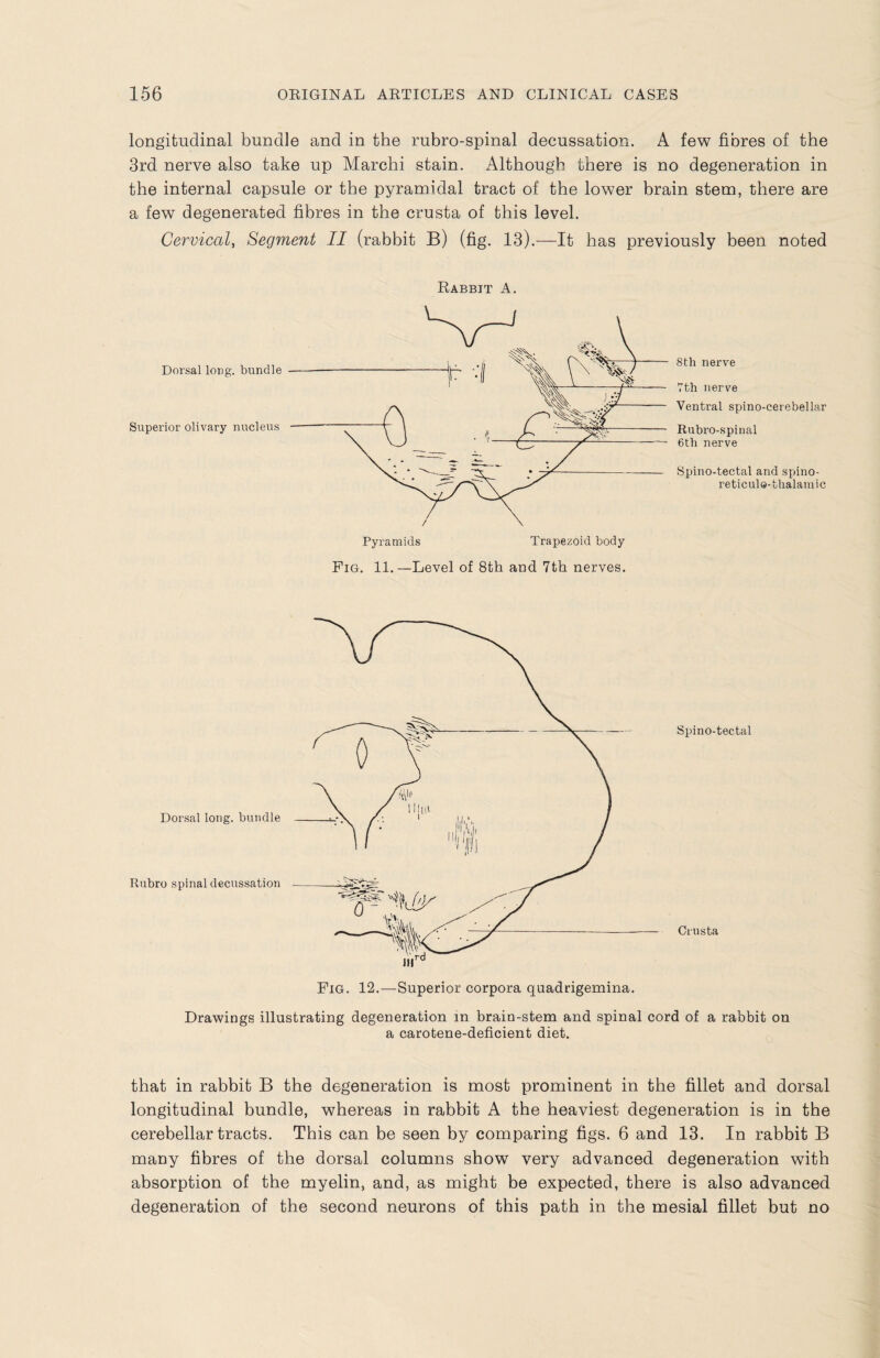 longitudinal bundle and in the rubro-spinal decussation. A few fibres of the 3rd nerve also take up Marchi stain. Although there is no degeneration in the internal capsule or the pyramidal tract of the lower brain stem, there are a few degenerated fibres in the crusta of this level. Cervical, Segment II (rabbit B) (fig. 13).—It has previously been noted Rabbit A. Dorsal long, bundle Superior olivary nucleus 8th nerve 7th nerve Ventral spino-cerebellar Rubro-spinal 6th nerve Spino-tectal and spino- reticulQ-thalamic Dorsal long, bundle Rubro spinal decussation Crusta Fig. 12.—Superior corpora quadrigemina. Drawings illustrating degeneration in brain-stem and spinal cord of a rabbit on a carotene-deficient diet. Spino-tectal that in rabbit B the degeneration is most prominent in the fillet and dorsal longitudinal bundle, whereas in rabbit A the heaviest degeneration is in the cerebellar tracts. This can be seen by comparing figs. 6 and 13. In rabbit B many fibres of the dorsal columns show very advanced degeneration with absorption of the myelin, and, as might be expected, there is also advanced degeneration of the second neurons of this path in the mesial fillet but no