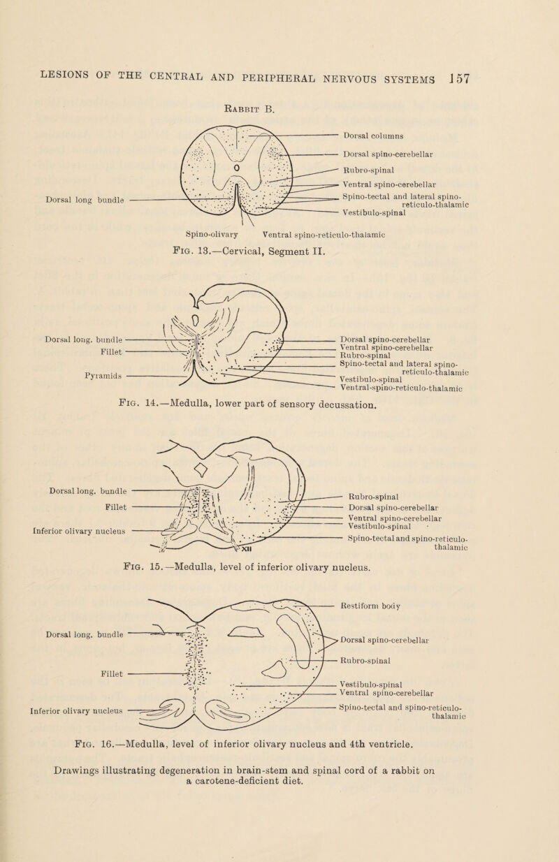 Rabbit B. Dorsal long bundle Dorsal columns Dorsal spino-cerebellar Rubro-spinal Ventral spino-cerebellar Spino-tectal and lateral spino- reticulo-thalamic Vestibulo-spinal Spino-olivary Ventral spino-reticulo-thalamic Fig. 13.—Cervical, Segment II. Dorsal spino-cerebellar Ventral spino-cerebellar Rubro-spinal Spino-tectal and lateral spino- reticulo-thalamic Vestibulo-spinal Ventral-spino-reticulo-thalamic Fig. 14.—Medulla, lower part of sensory decussation. Dorsal long, bundle Fillet Inferior olivary nucleus Rubro-spinal Dorsal spino-cerebellar Ventral spino-cerebellar Vestibulo-spinal Spino-tectal and spino-reticulo- thalamic Fig. 15.—Medulla, level of inferior olivary nucleus. Dorsal long, bundle Fillet Inferior olivary nucleus Restiform body Dorsal spino-cerebellar Rubro-spinal Vestibulo-spinal Ventral spino-cerebellar Spino-tectal and spino-reticulo- thalamic Fig. 16.—Medulla, level of inferior olivary nucleus and 4th ventricle. Drawings illustrating degeneration in brain-stem and spinal cord of a rabbit on a carotene-deficient diet.