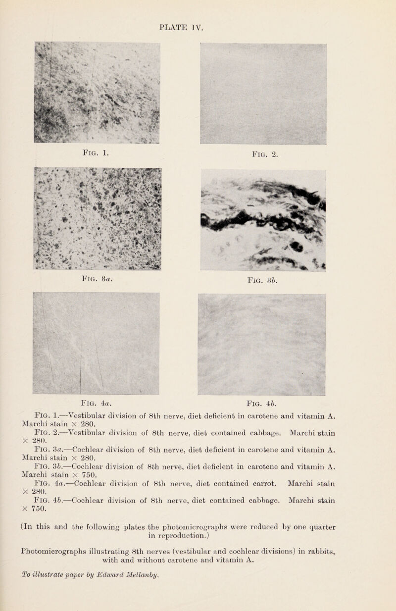 Fig. 4a. Fig. 4b. Fig. 1.—Vestibular division of 8th nerve, diet deficient in carotene and vitamin A. Marchi stain X 280. Fig. 2.—Vestibular division of 8th nerve, diet contained cabbage. Marchi stain X 280. Fig. 3a.—Cochlear division of 8th nerve, diet deficient in carotene and vitamin A. Marchi stain X 280. Fig. 36.—Cochlear division of 8bh nerve, diet deficient in carotene and vitamin A. Marchi stain X 750. Fig. 4a.—Cochlear division of 8th nerve, diet contained carrot. Marchi stain X 280. Fig. 46.—Cochlear division of 8th nerve, diet contained cabbage. Marchi stain X 750. (In this and the following plates the photomicrographs were reduced by one quarter in reproduction.) Photomicrographs illustrating 8th nerves (vestibular and cochlear divisions) in rabbits, with and without carotene and vitamin A.