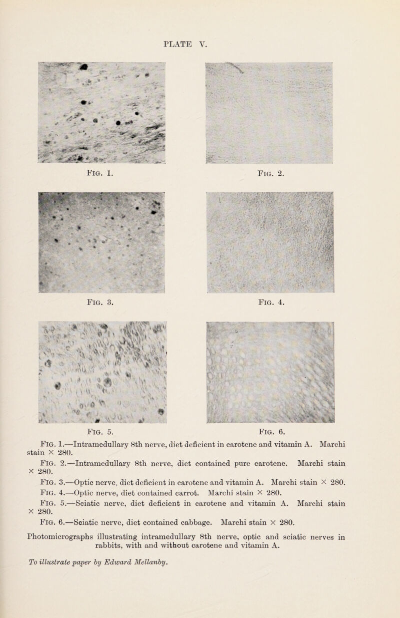 Fig. 1. s. „ f ■ • .• V 11 ■ ' r ' K * * £ Fig. 5. Fig. 1.—Intramedullary 8th nerve, diet deficient in carotene and vitamin A. Marchi stain X 280. Fig. 2.—Intramedullary 8th nerve, diet contained pure carotene. Marchi stain X 280, Fig. 3.—Optic nerve, diet deficient in carotene and vitamin A. Marchi stain X 280. Fig. 4.—Optic nerve, diet contained carrot. Marchi stain X 280. Fig. 5.—Sciatic nerve, diet deficient in carotene and vitamin A. Marchi stain X 280. Fig. 6.—Sciatic nerve, diet contained cabbage. Marchi stain X 280. Photomicrographs illustrating intramedullary 8th nerve, optic and sciatic nerves in rabbits, with and without carotene and vitamin A.